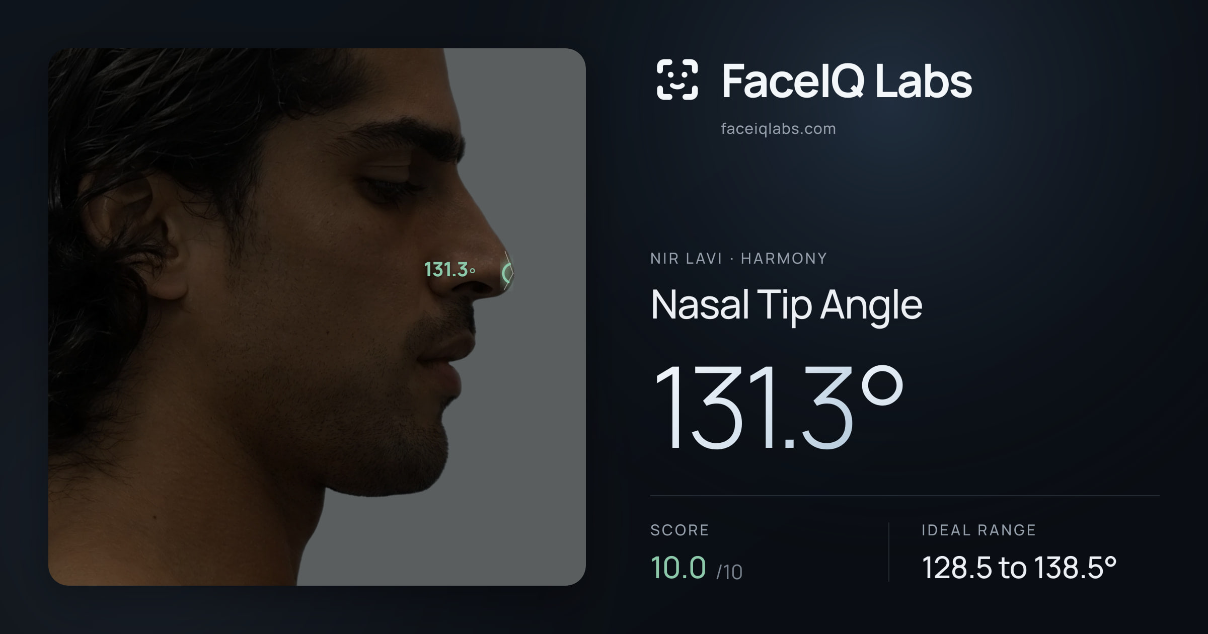 Nir Lavi Nasal Tip Angle: 131.3°, drawn on the photo