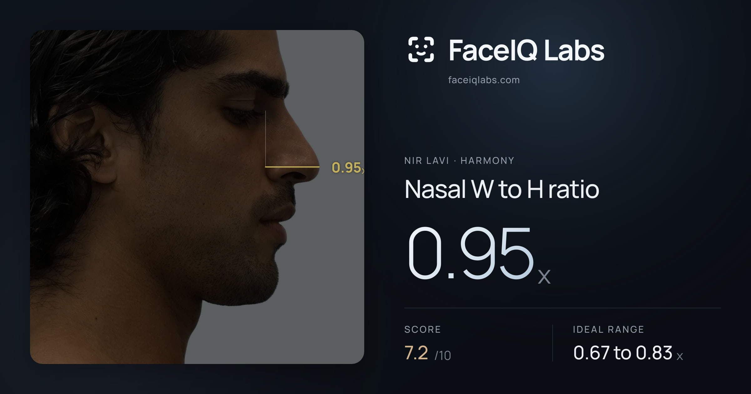 Nir Lavi Nasal W to H ratio: 0.95x, drawn on the photo