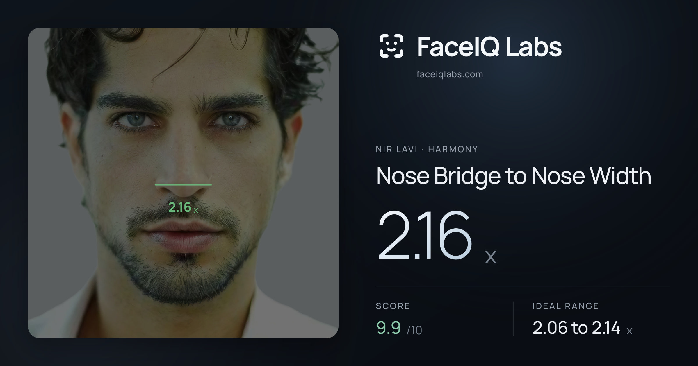 Nir Lavi Nose Bridge to Nose Width: 2.16x, drawn on the photo