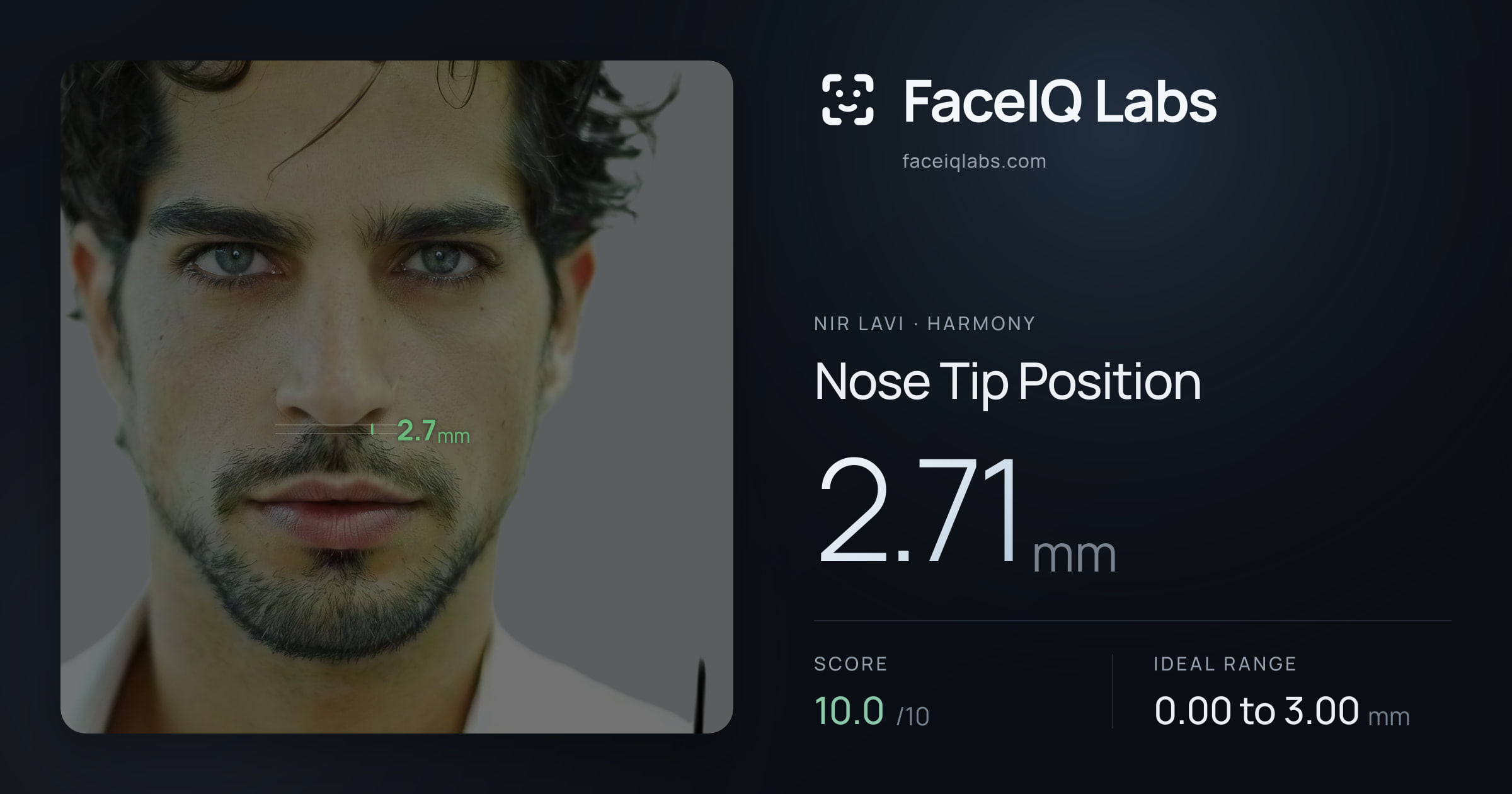 Nir Lavi Nose Tip Position: 2.71mm, drawn on the photo