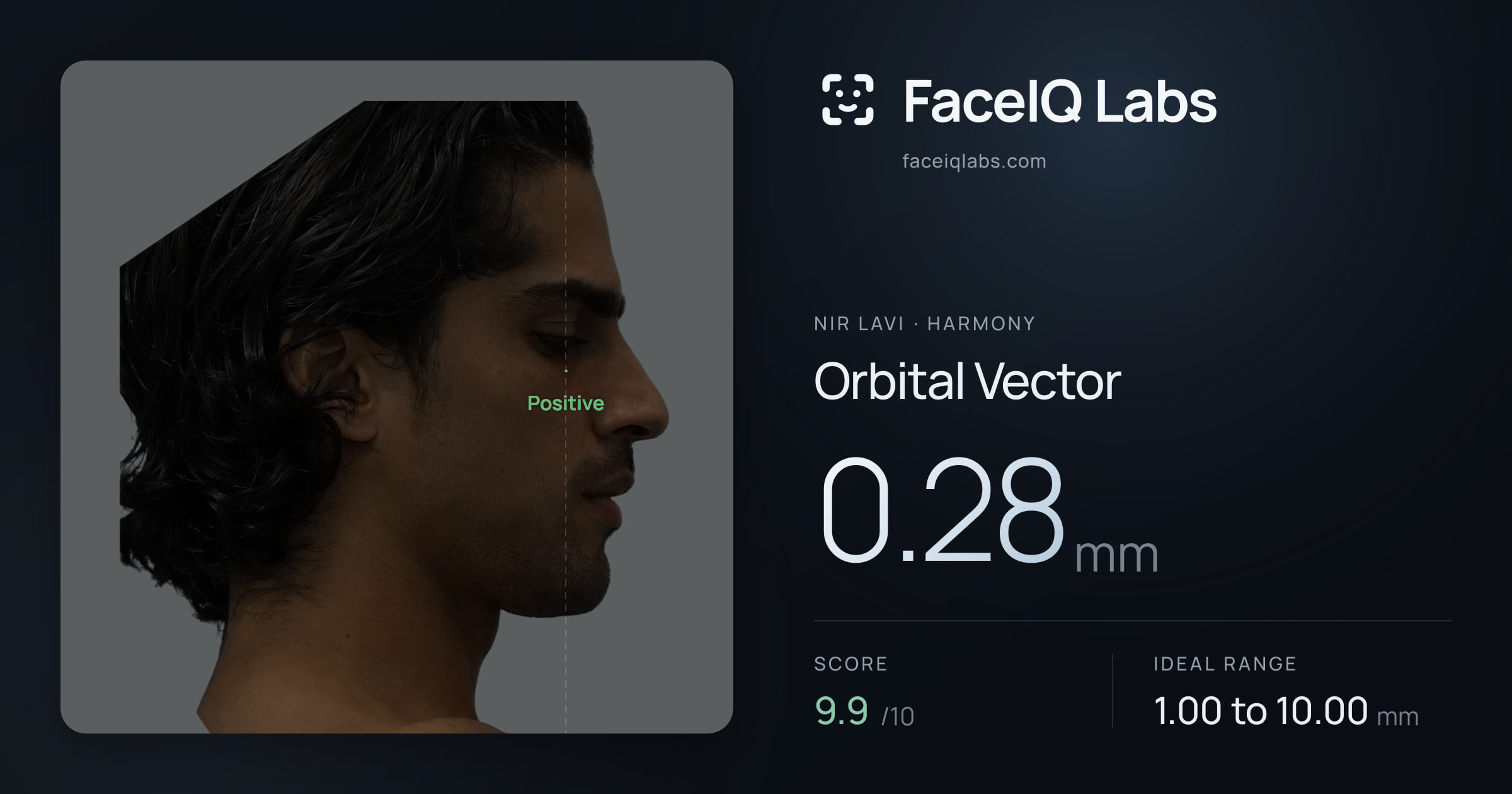 Nir Lavi Orbital Vector: 0.28mm, drawn on the photo
