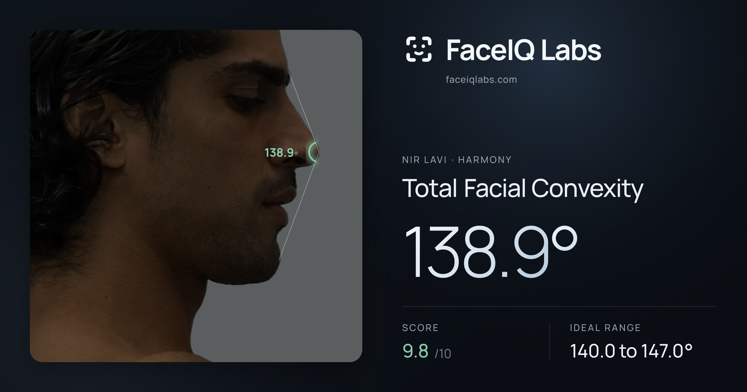 Nir Lavi Total Facial Convexity: 138.9°, drawn on the photo