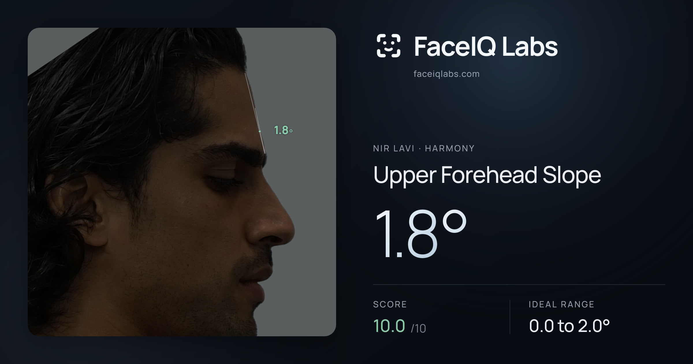 Nir Lavi Upper Forehead Slope: 1.8°, drawn on the photo