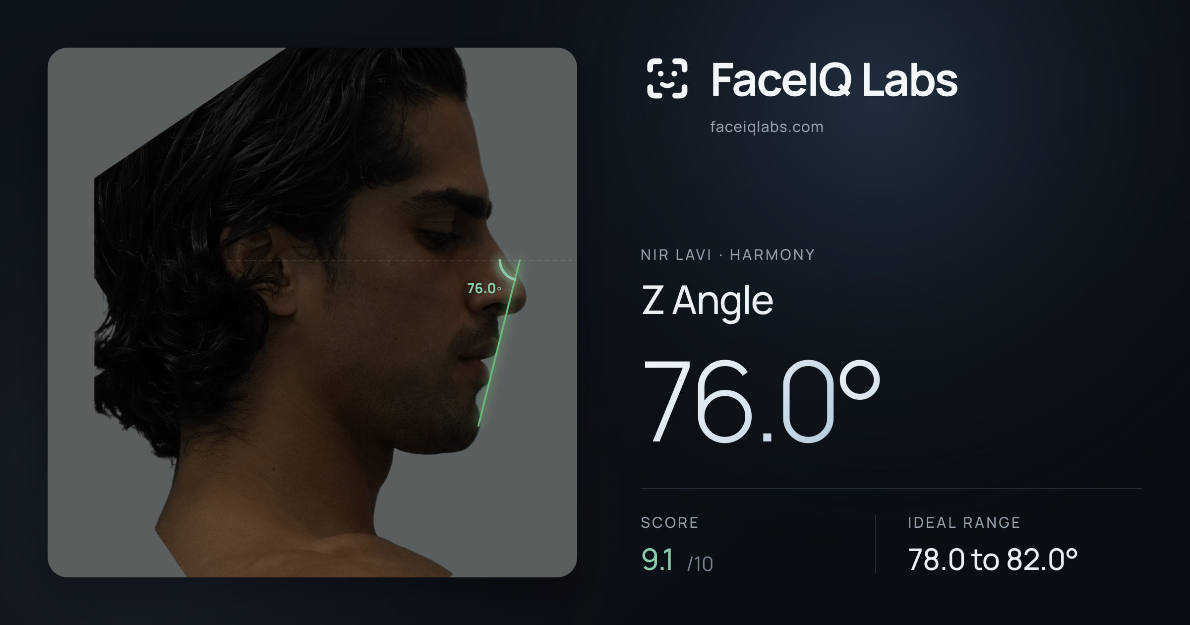 Nir Lavi Z Angle: 76.0°, drawn on the photo