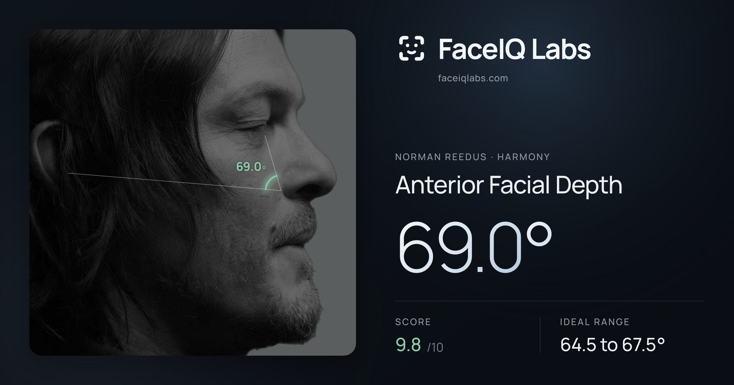 Norman Reedus Anterior Facial Depth: 69.0°, drawn on the photo