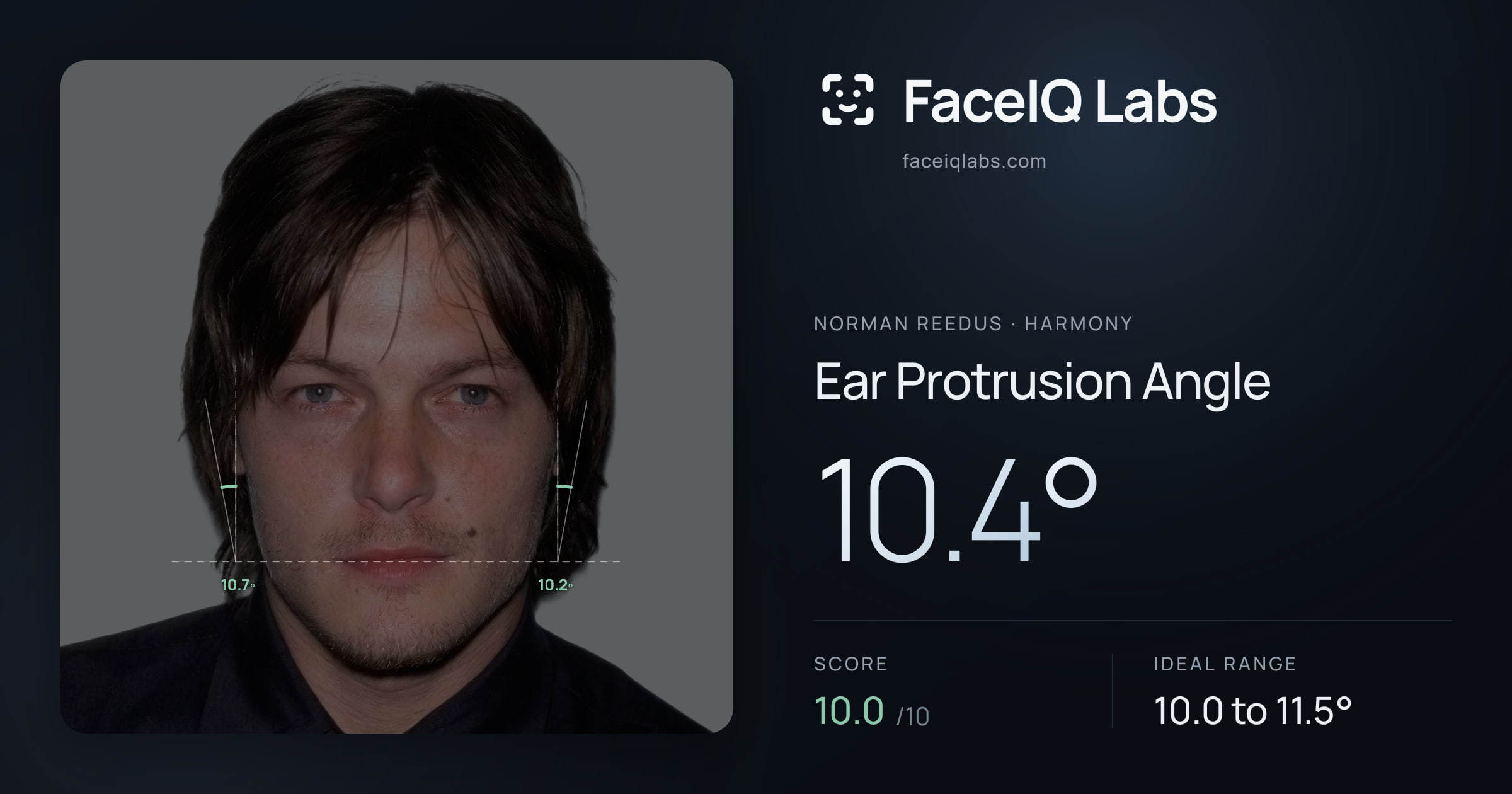 Norman Reedus Ear Protrusion Angle: 10.4°, drawn on the photo