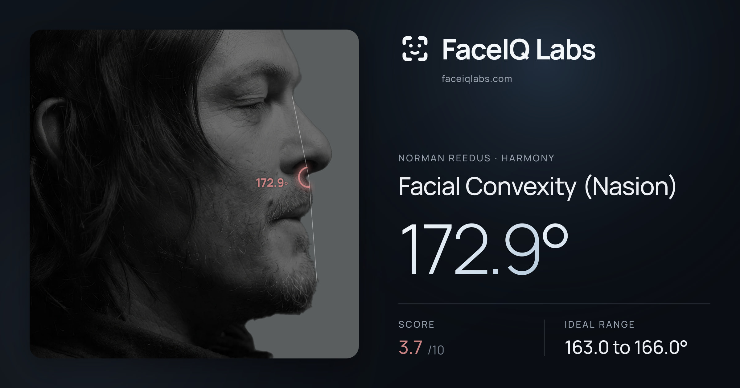 Norman Reedus Facial Convexity (Nasion): 172.9°, drawn on the photo