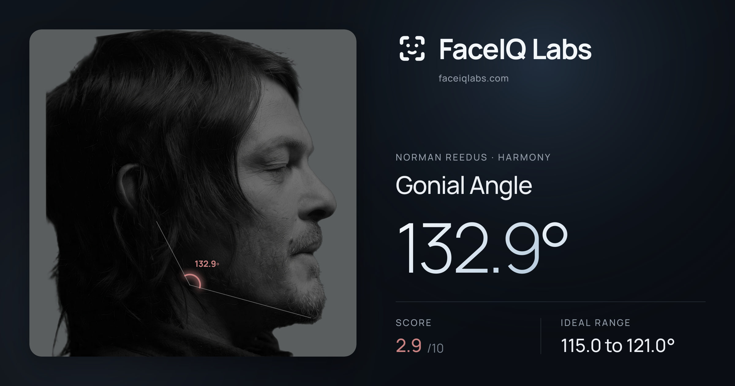 Norman Reedus Gonial Angle: 132.9°, drawn on the photo