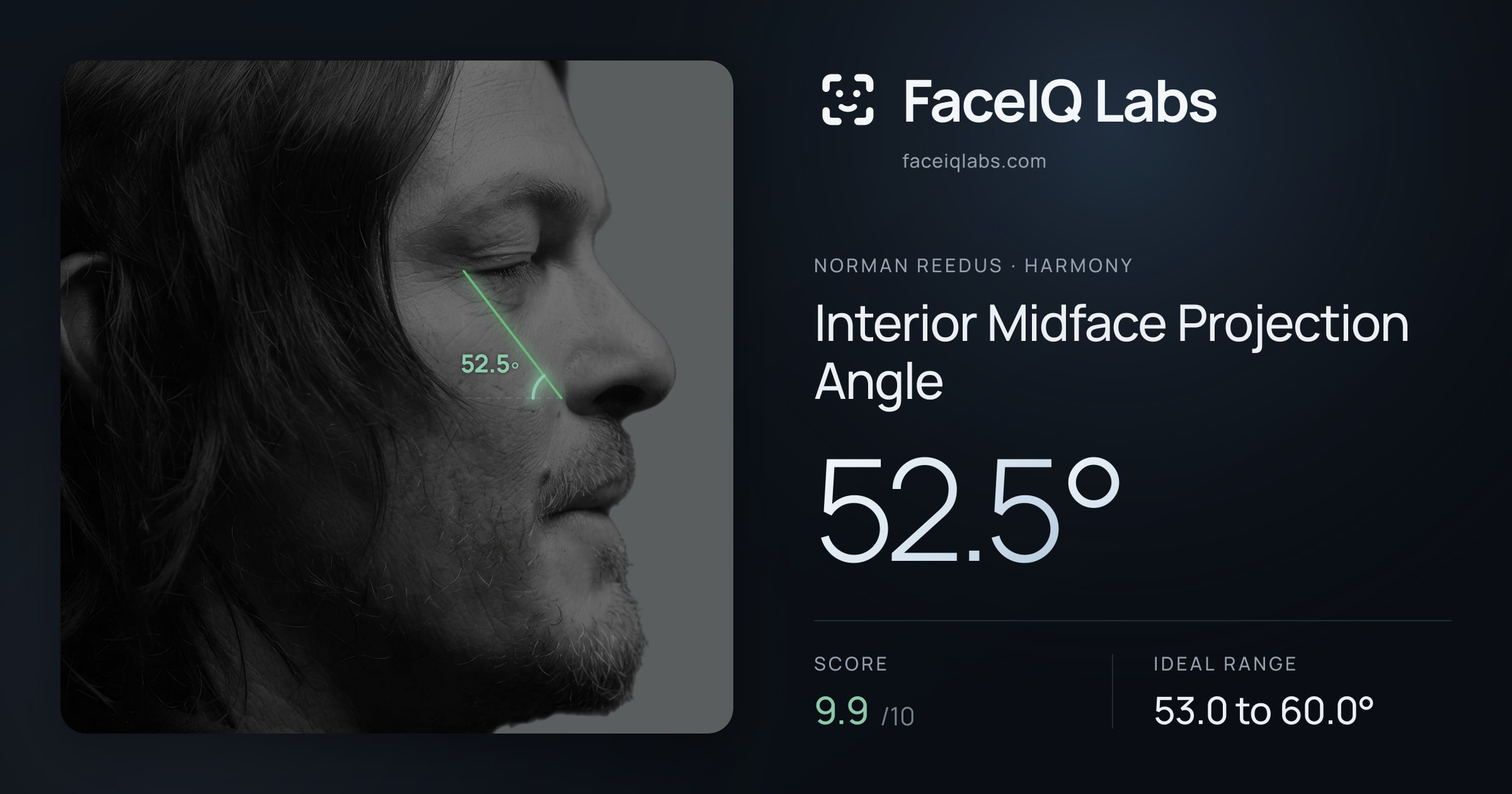 Norman Reedus Interior Midface Projection Angle: 52.5°, drawn on the photo