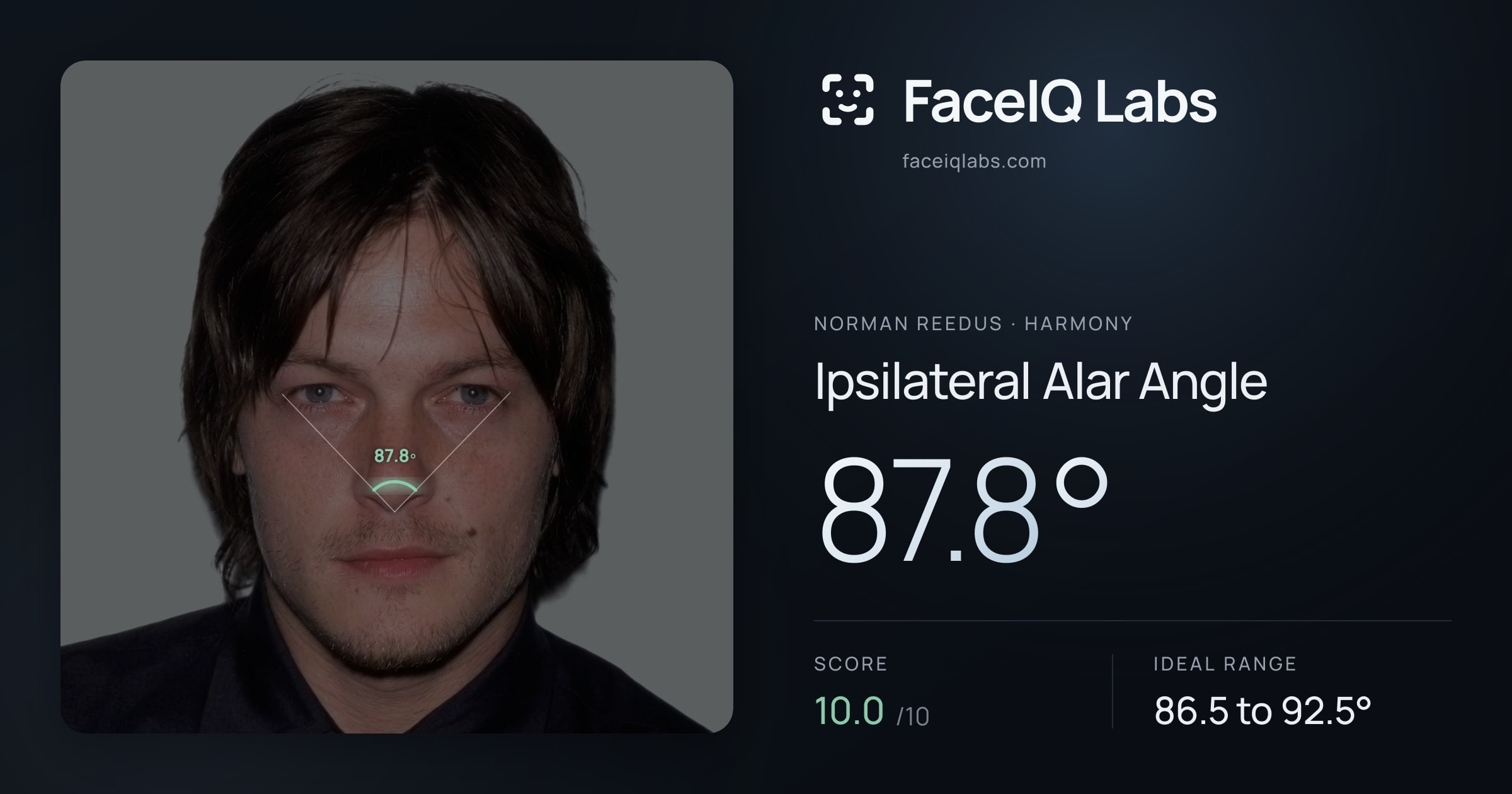 Norman Reedus Ipsilateral Alar Angle: 87.8°, drawn on the photo