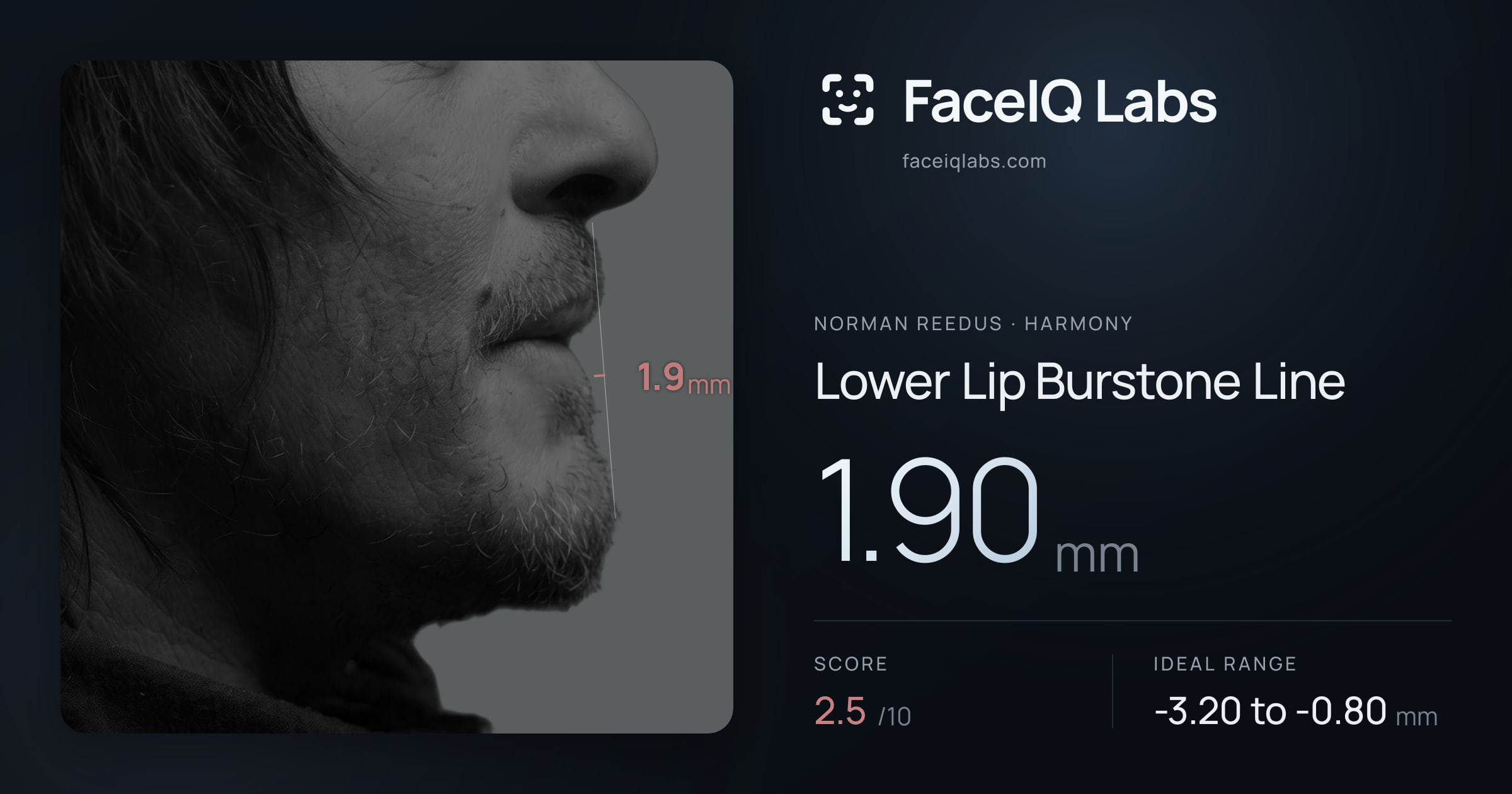 Norman Reedus Lower Lip Burstone Line: 1.90mm, drawn on the photo