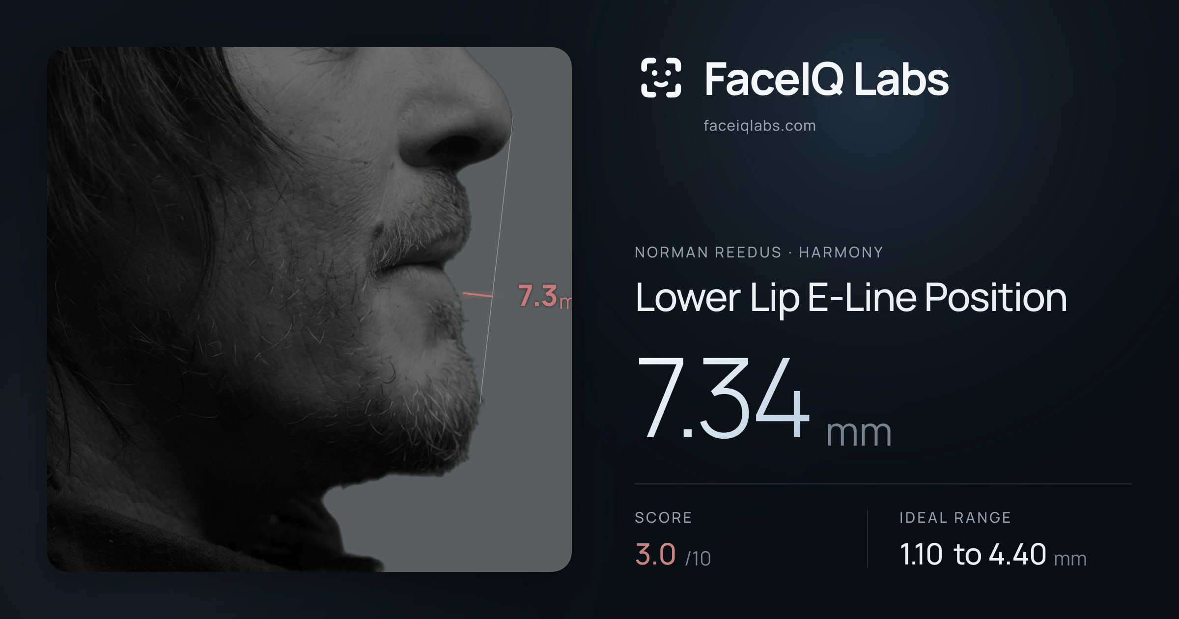 Norman Reedus Lower Lip E-Line Position: 7.34mm, drawn on the photo