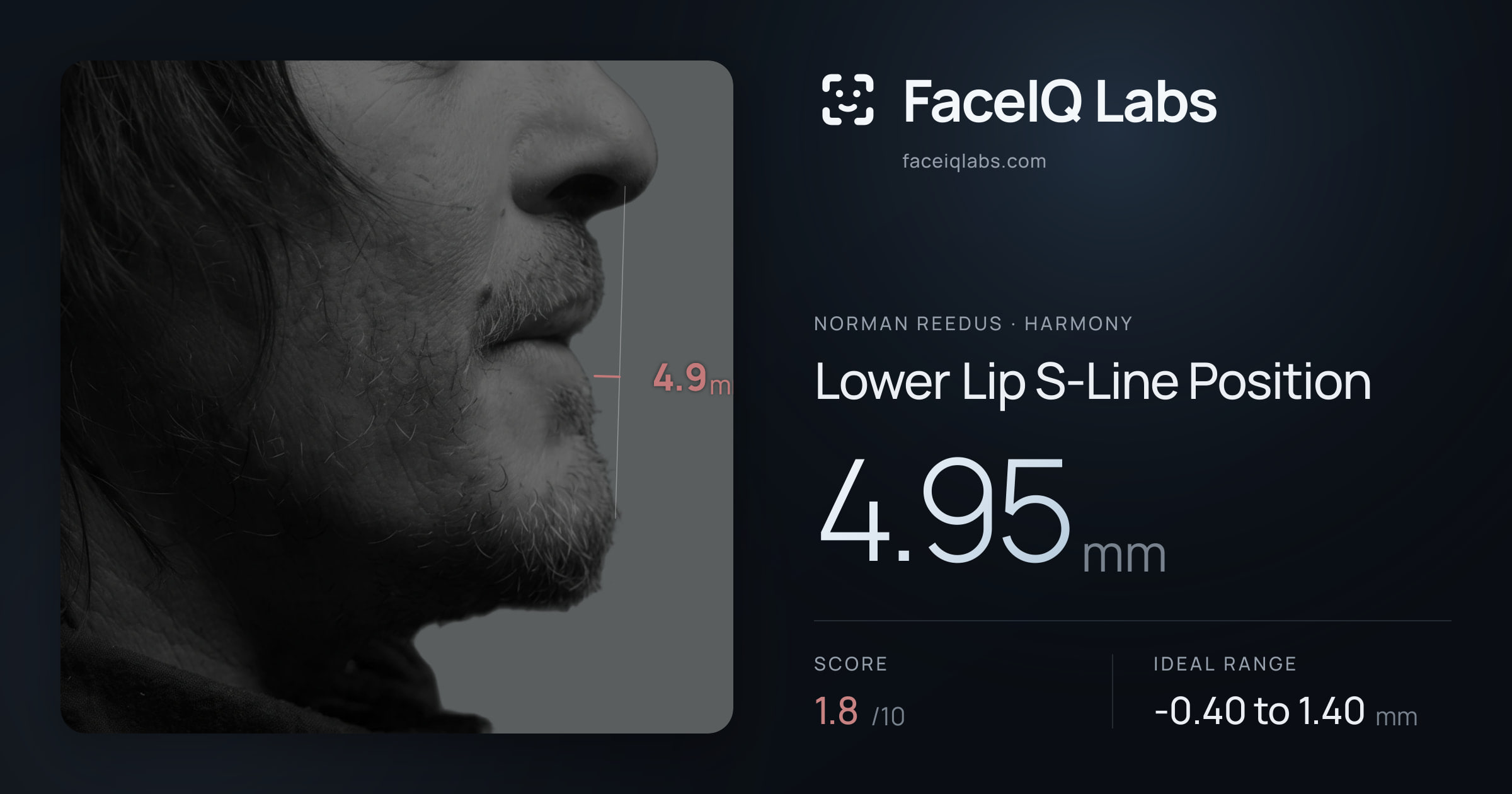 Norman Reedus Lower Lip S-Line Position: 4.95mm, drawn on the photo