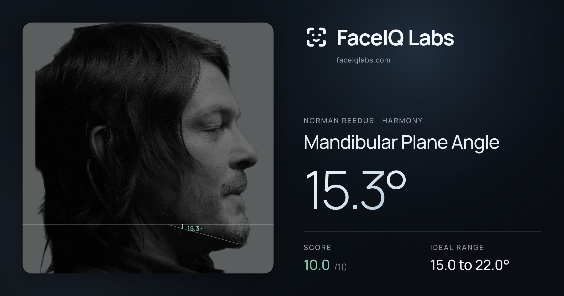 Norman Reedus Mandibular Plane Angle: 15.3°, drawn on the photo
