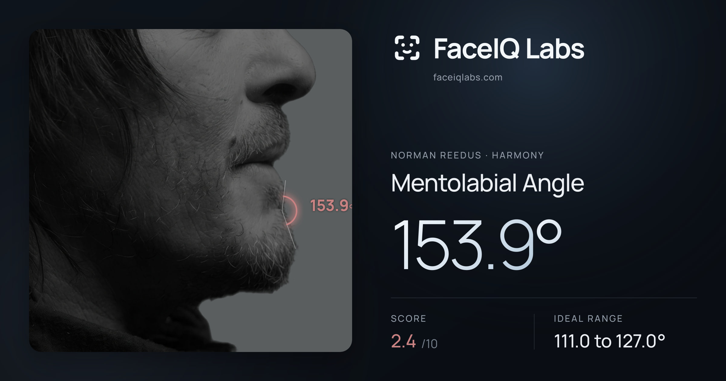 Norman Reedus Mentolabial Angle: 153.9°, drawn on the photo