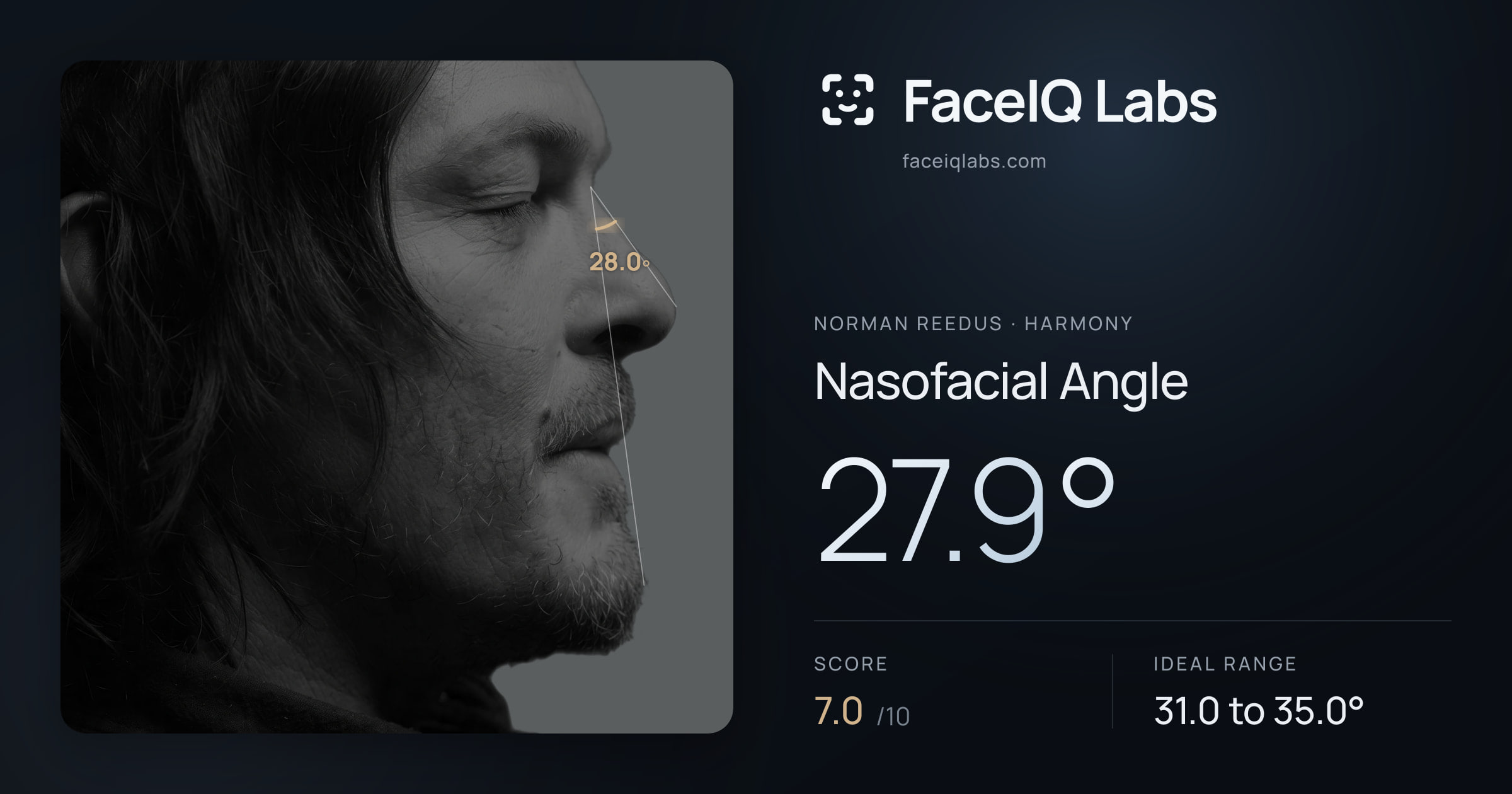Norman Reedus Nasofacial Angle: 27.9°, drawn on the photo