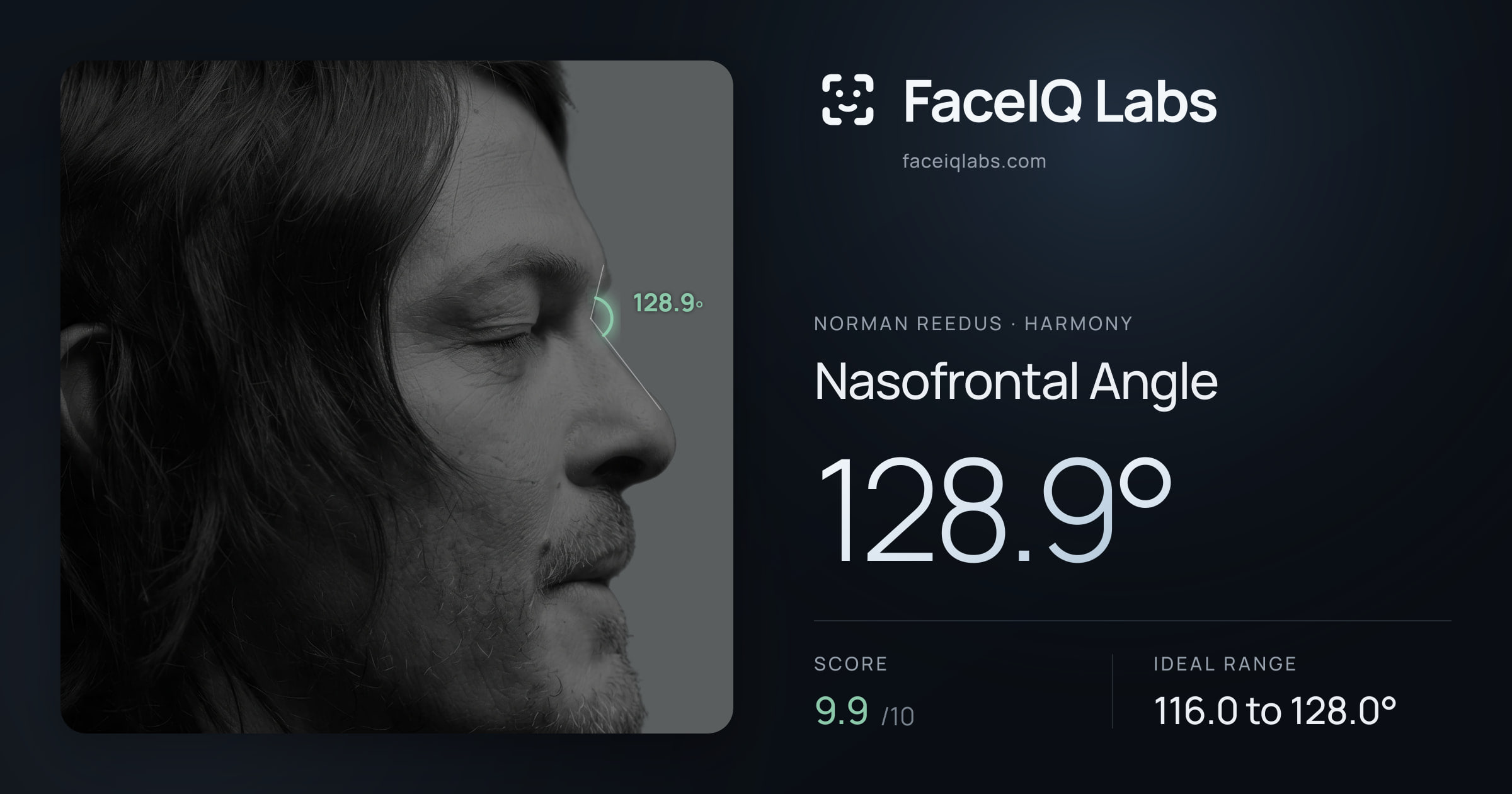 Norman Reedus Nasofrontal Angle: 128.9°, drawn on the photo