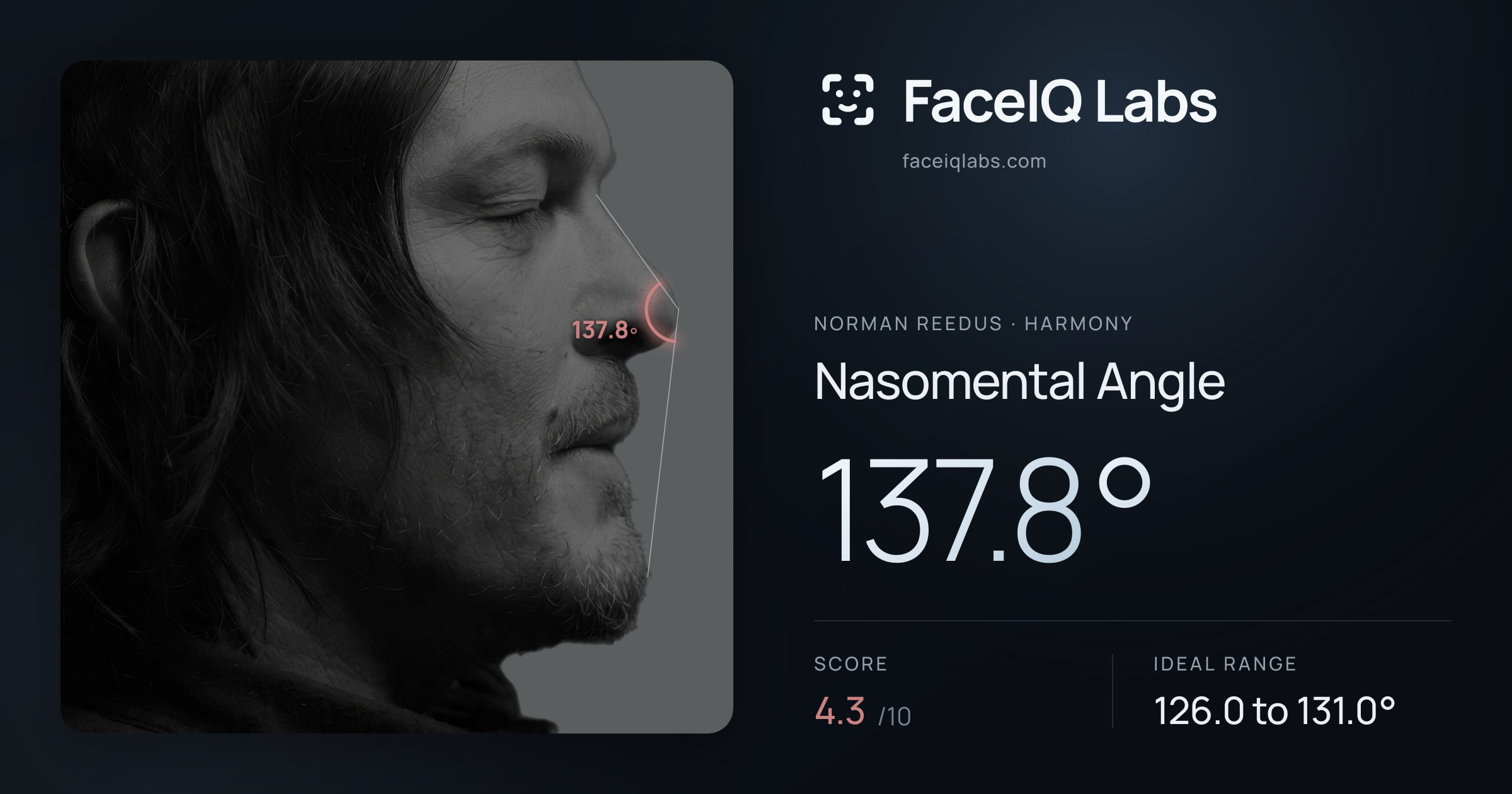 Norman Reedus Nasomental Angle: 137.8°, drawn on the photo