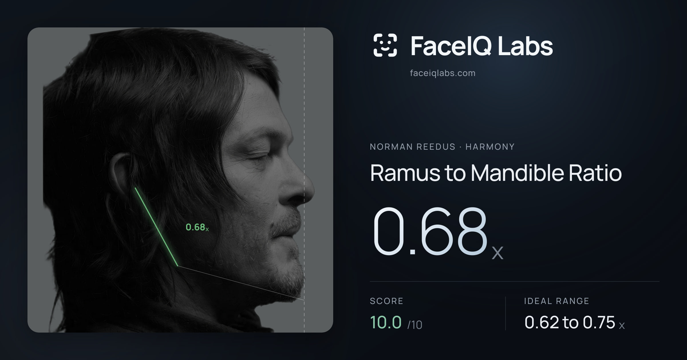 Norman Reedus Ramus to Mandible Ratio: 0.68x, drawn on the photo