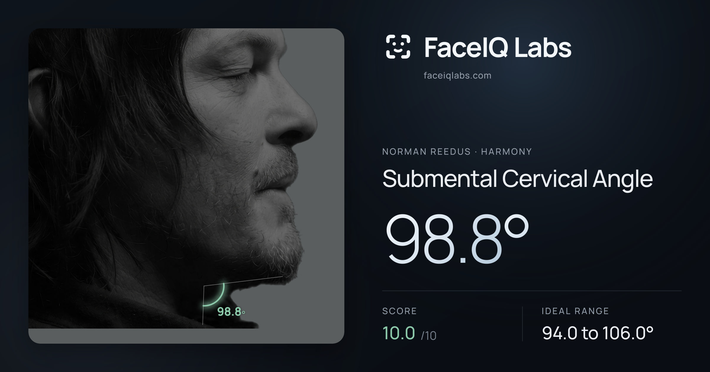 Norman Reedus Submental Cervical Angle: 98.8°, drawn on the photo