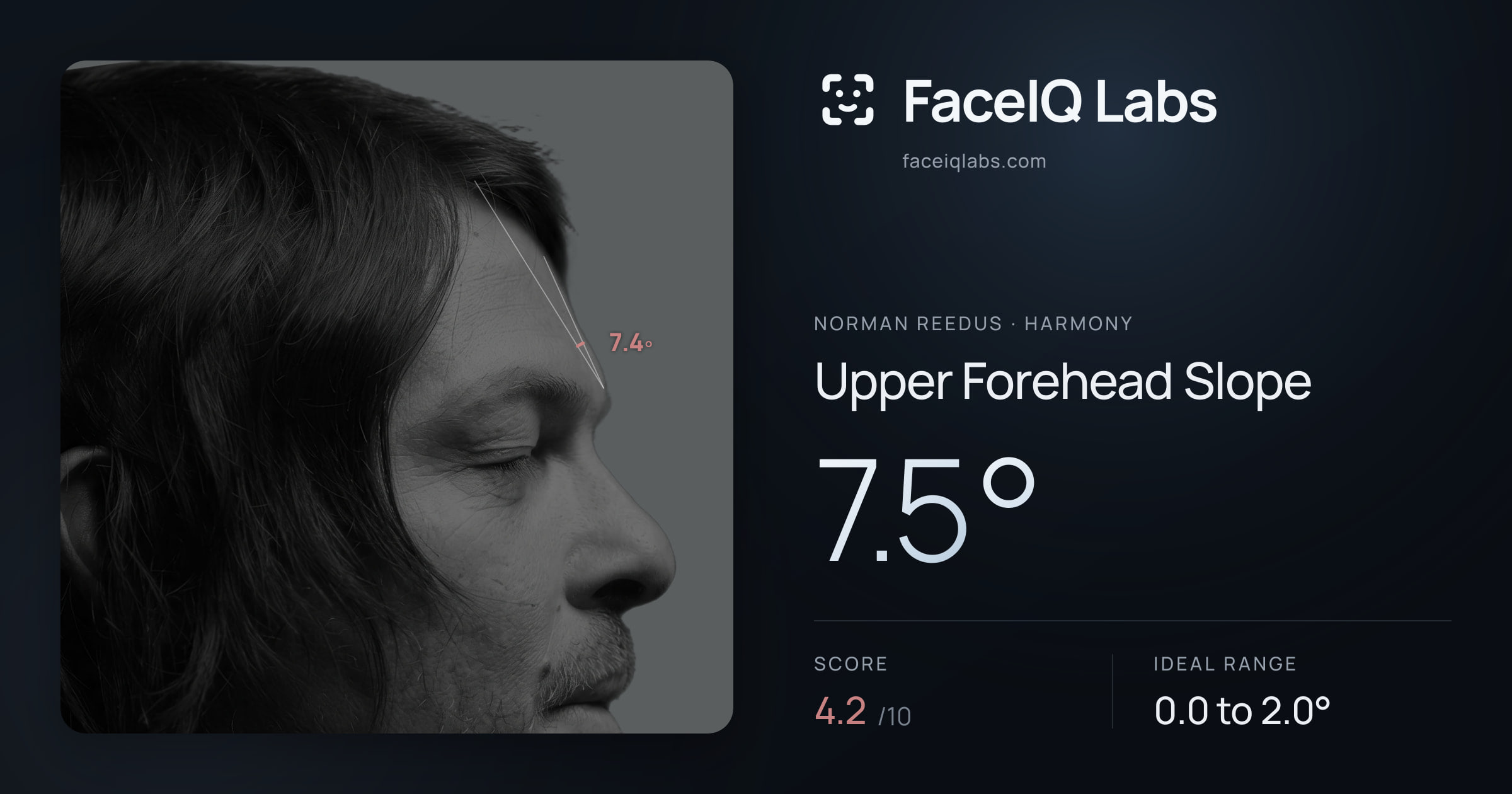 Norman Reedus Upper Forehead Slope: 7.5°, drawn on the photo
