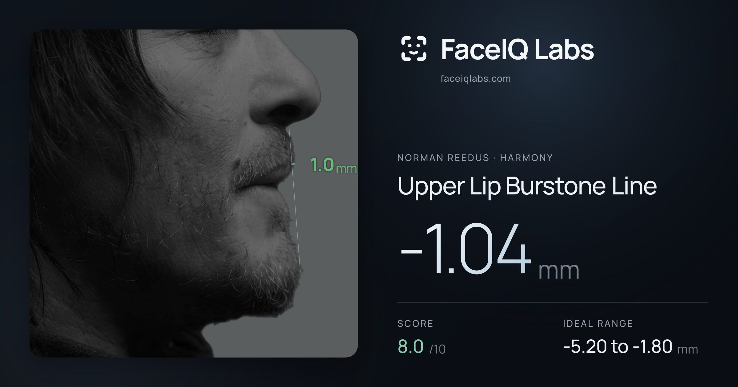 Norman Reedus Upper Lip Burstone Line: -1.04mm, drawn on the photo