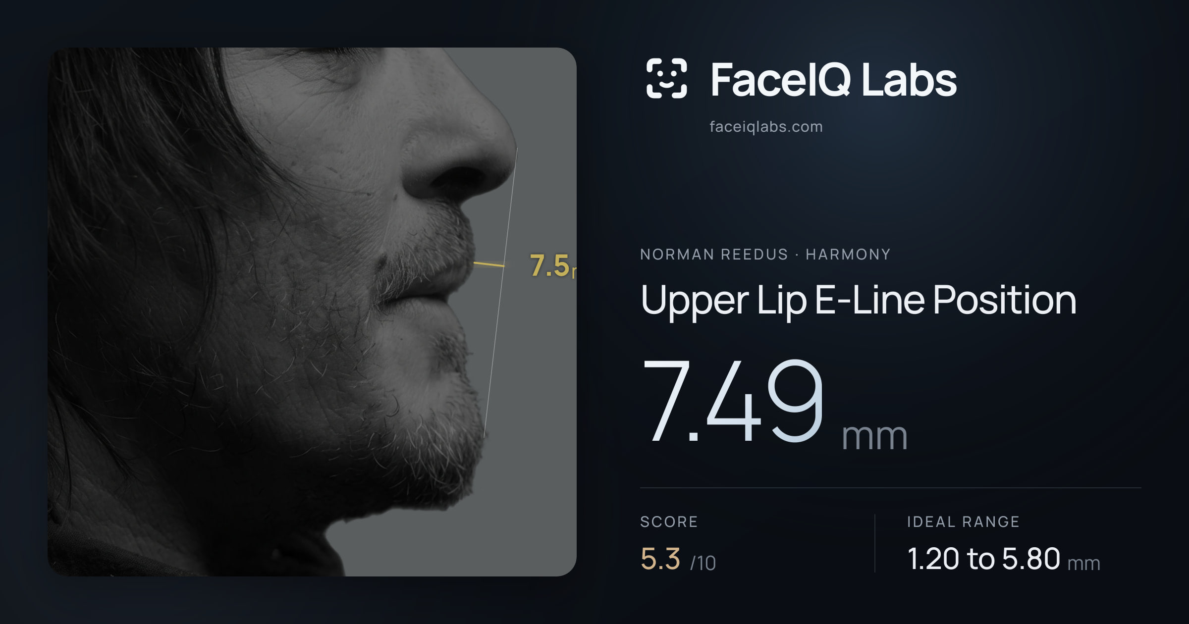 Norman Reedus Upper Lip E-Line Position: 7.49mm, drawn on the photo