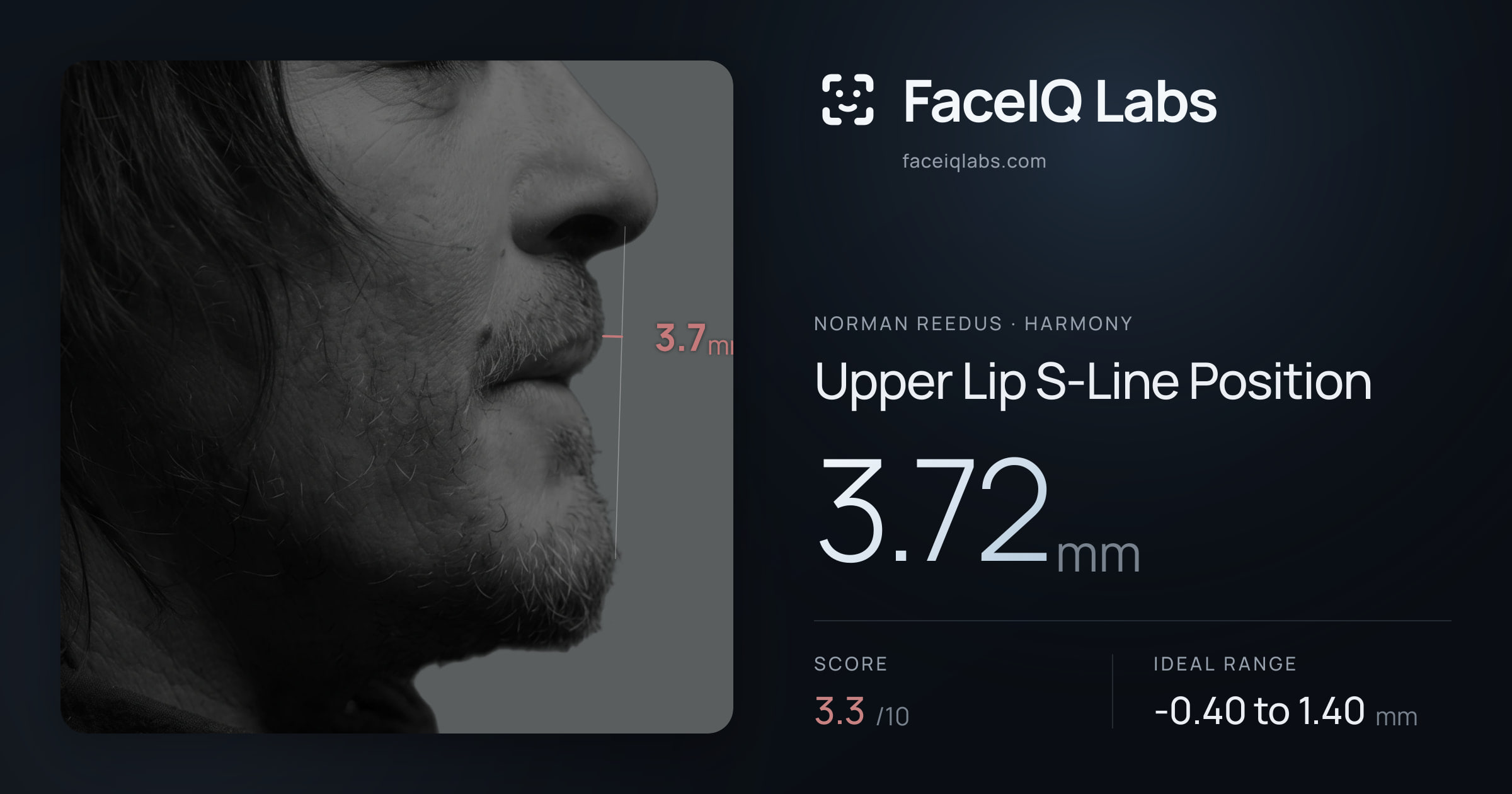 Norman Reedus Upper Lip S-Line Position: 3.72mm, drawn on the photo