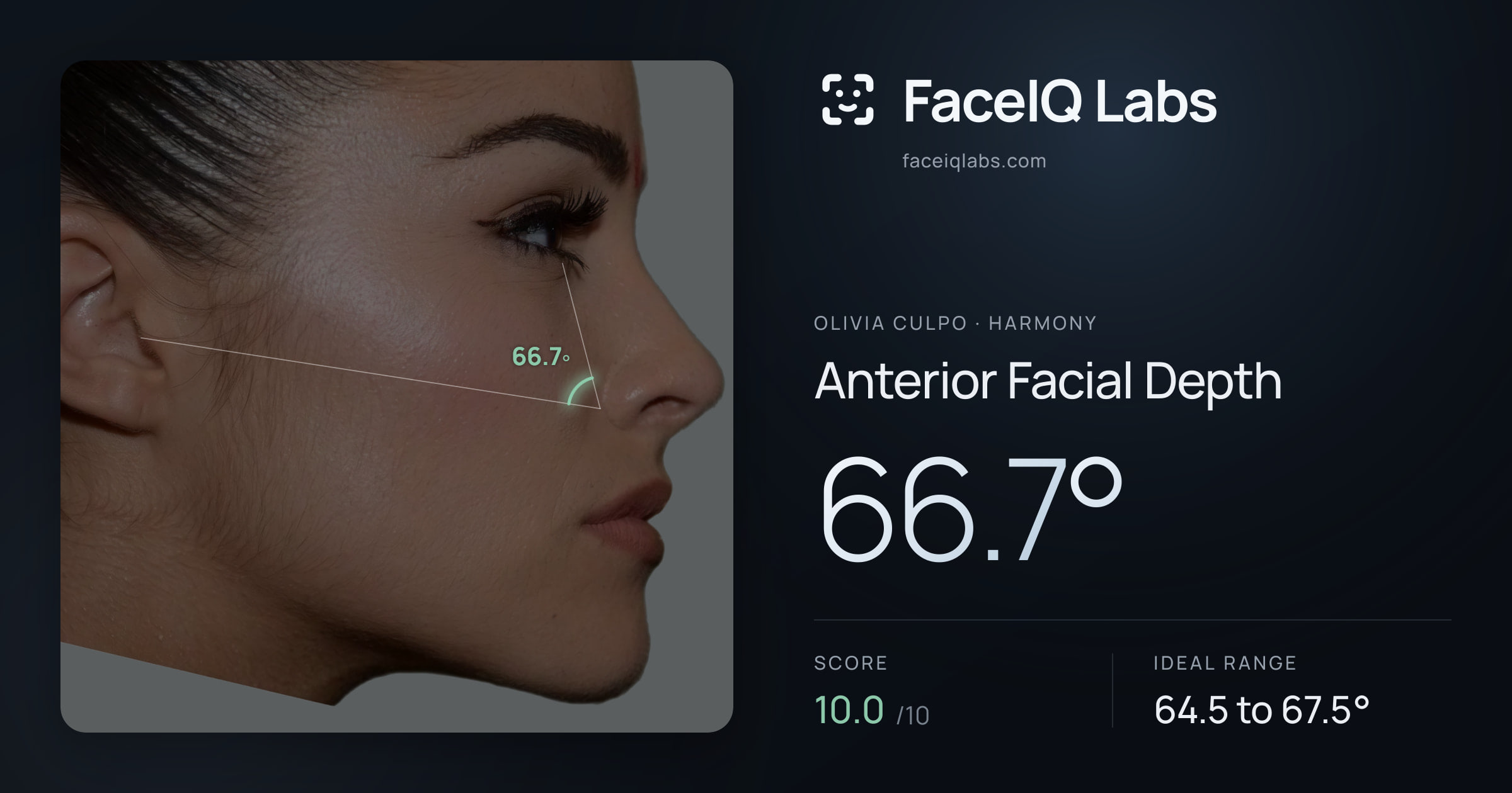 Olivia Culpo Anterior Facial Depth: 66.7°, drawn on the photo