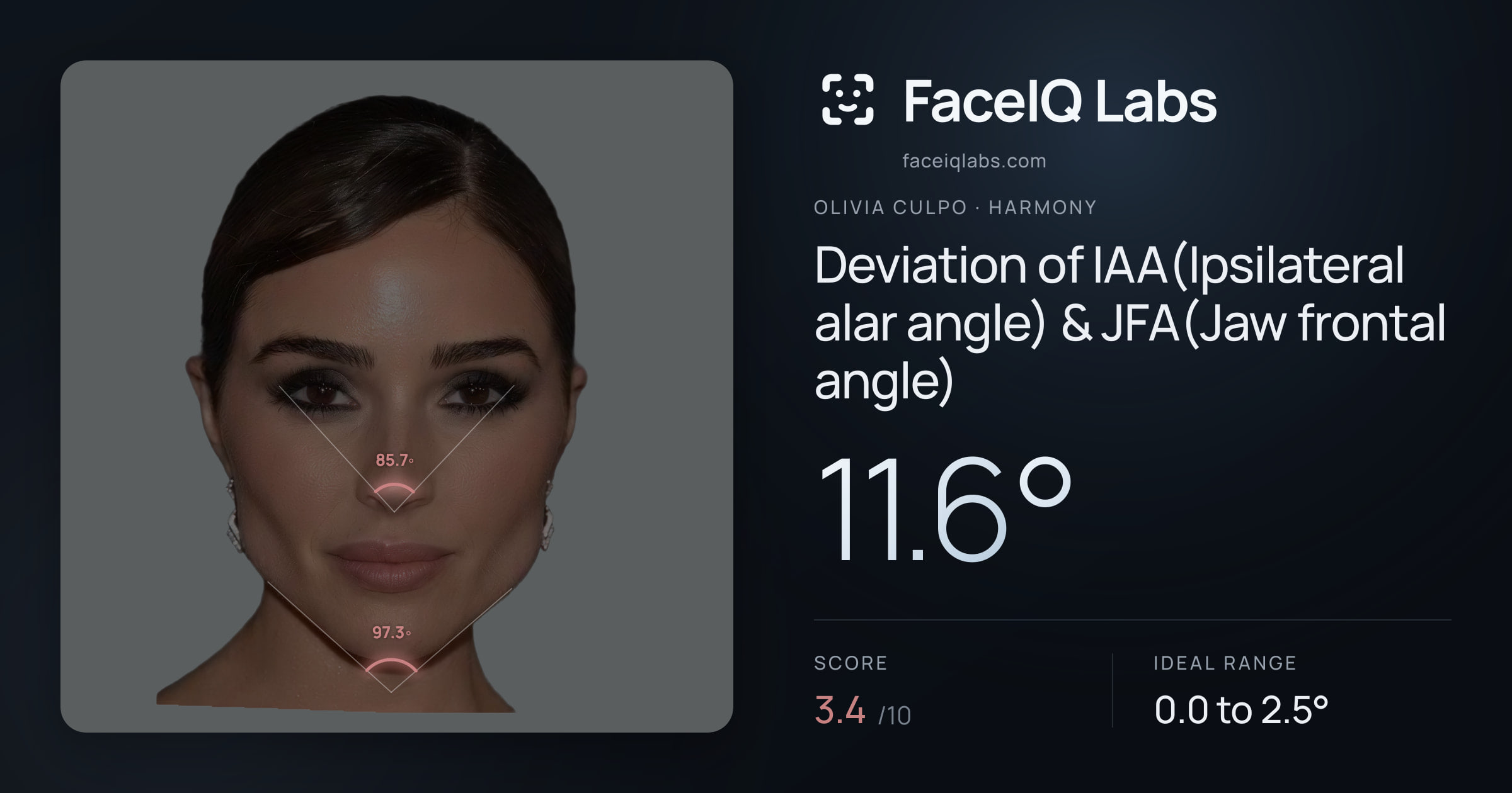 Olivia Culpo Deviation of IAA(Ipsilateral alar angle) & JFA(Jaw frontal angle): 11.6°, drawn on the photo