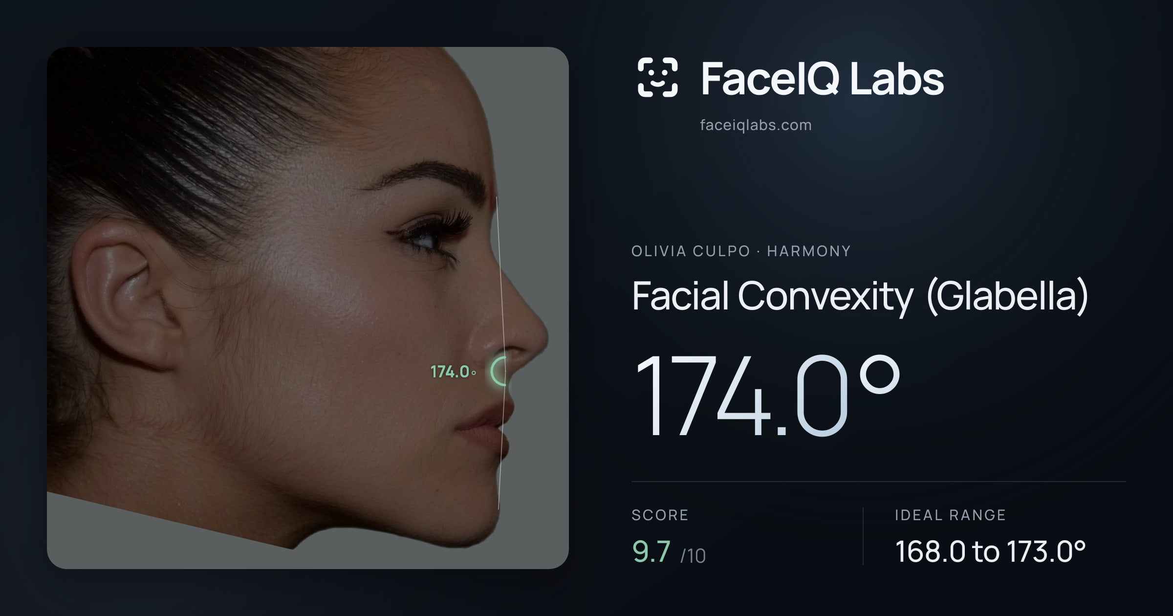Olivia Culpo Facial Convexity (Glabella): 174.0°, drawn on the photo