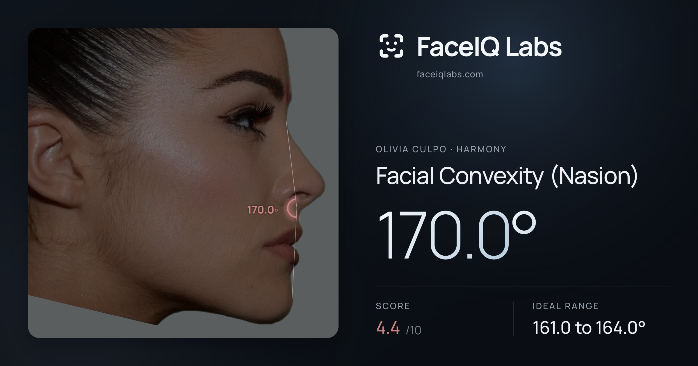 Olivia Culpo Facial Convexity (Nasion): 170.0°, drawn on the photo