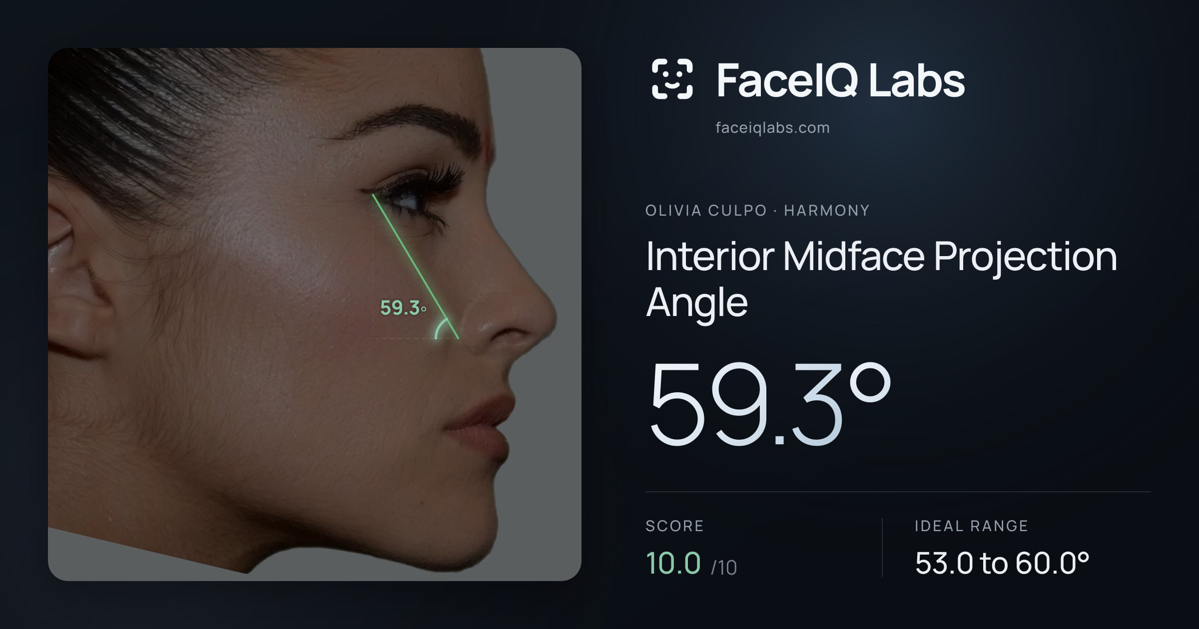 Olivia Culpo Interior Midface Projection Angle: 59.3°, drawn on the photo