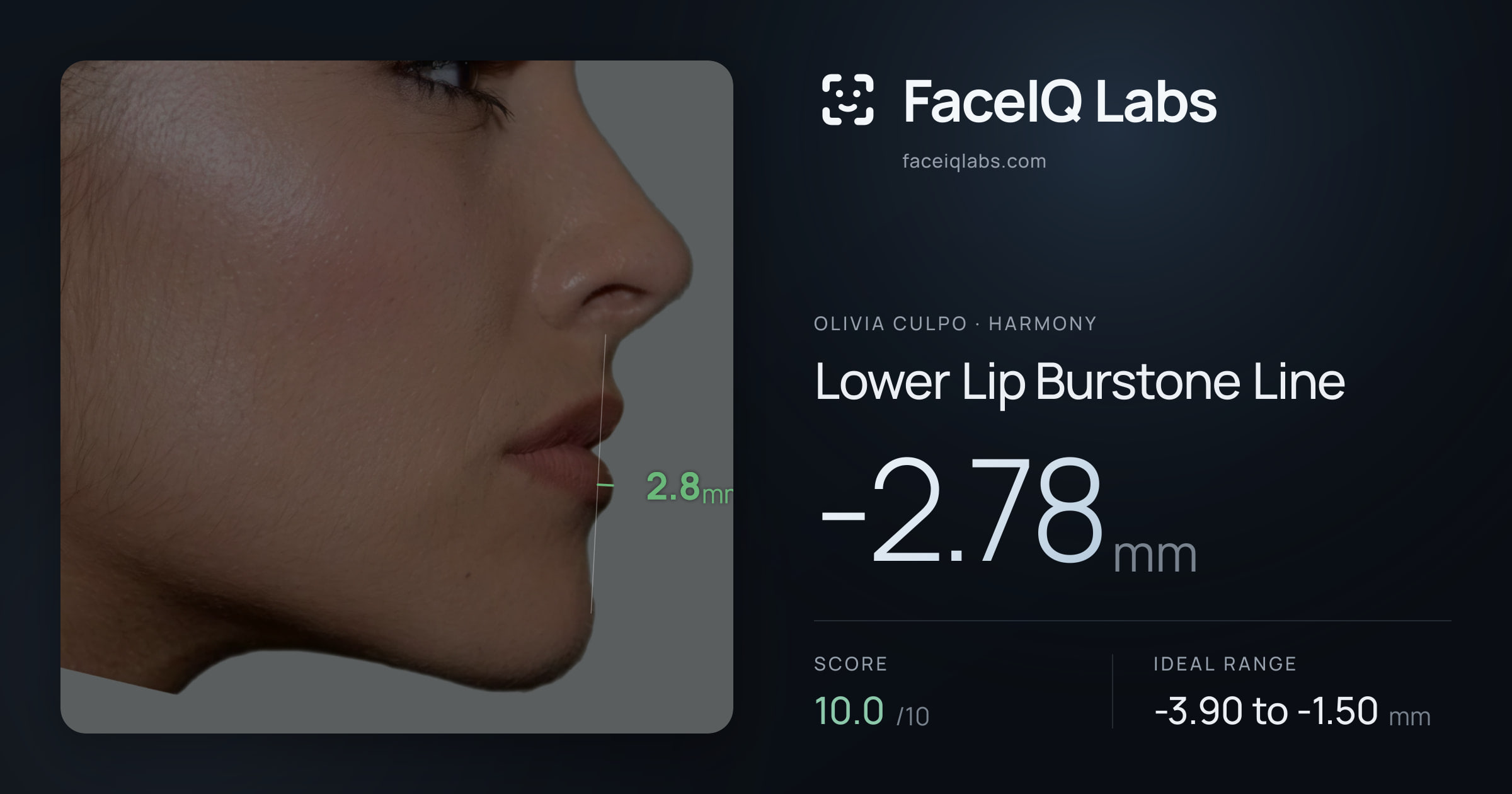 Olivia Culpo Lower Lip Burstone Line: -2.78mm, drawn on the photo