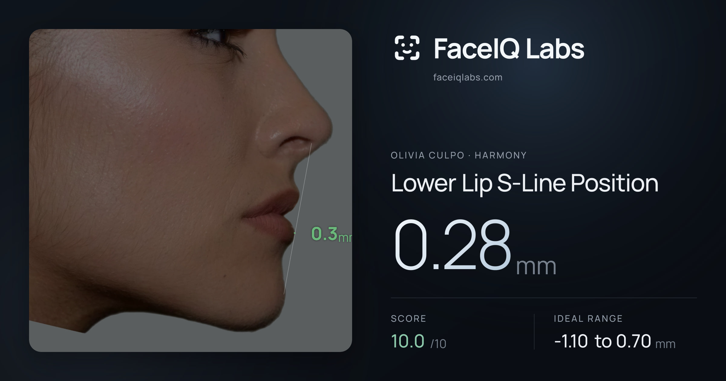 Olivia Culpo Lower Lip S-Line Position: 0.28mm, drawn on the photo