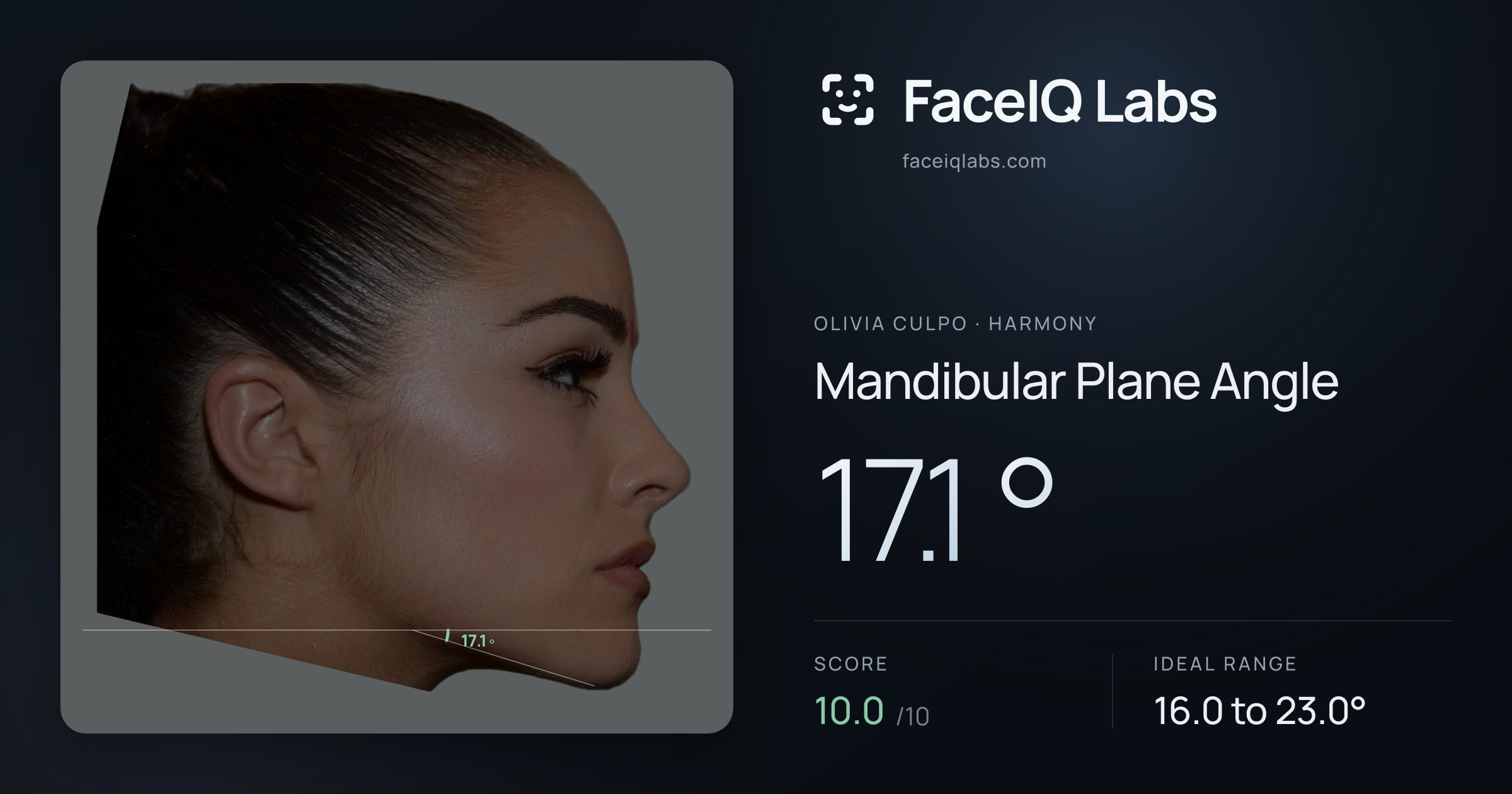 Olivia Culpo Mandibular Plane Angle: 17.1°, drawn on the photo