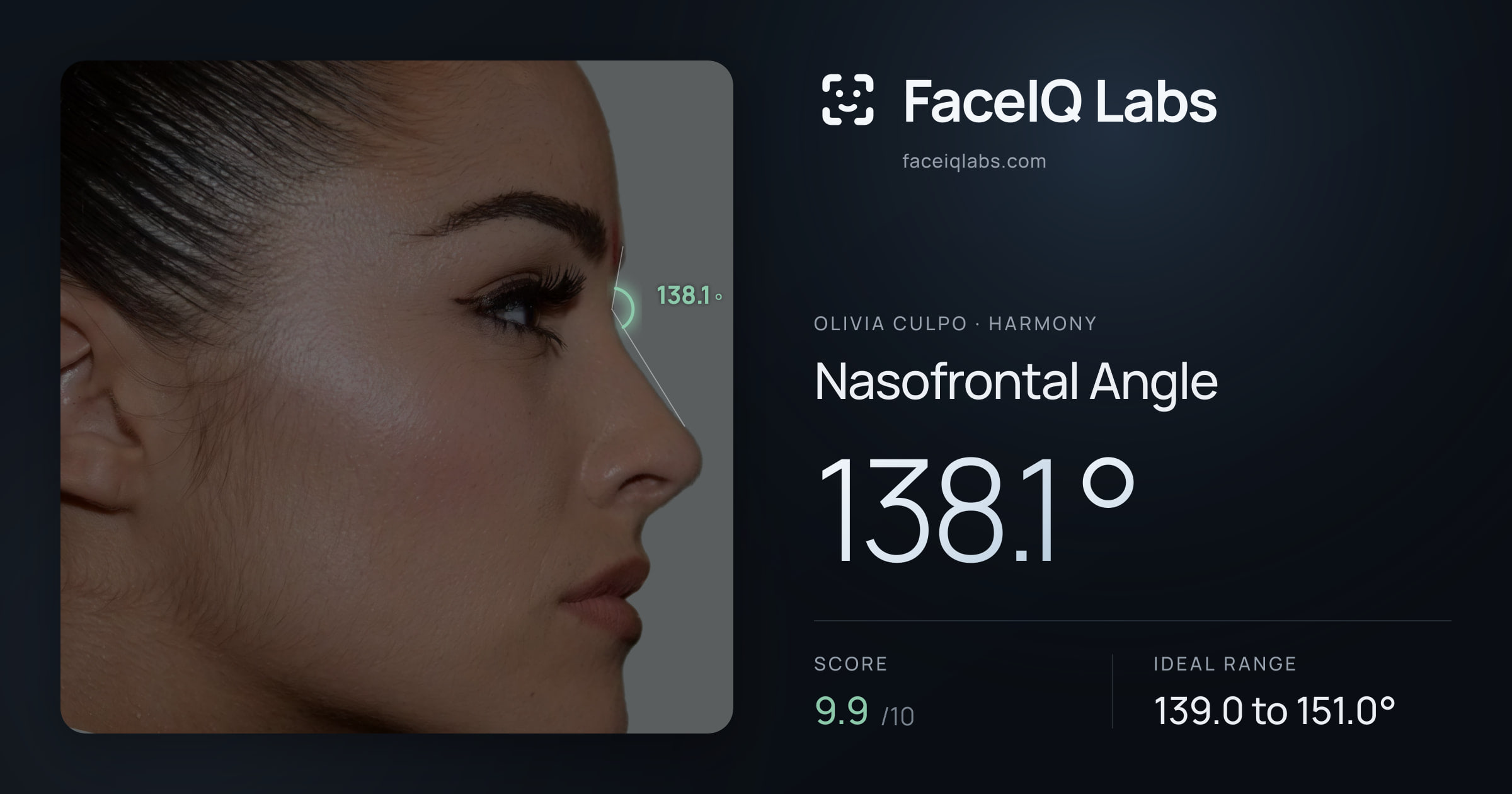 Olivia Culpo Nasofrontal Angle: 138.1°, drawn on the photo