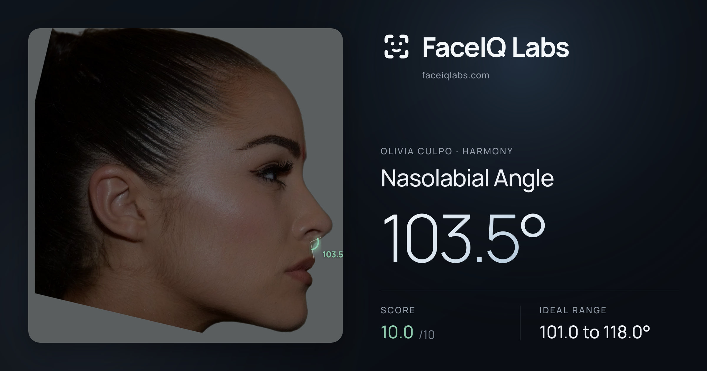 Olivia Culpo Nasolabial Angle: 103.5°, drawn on the photo