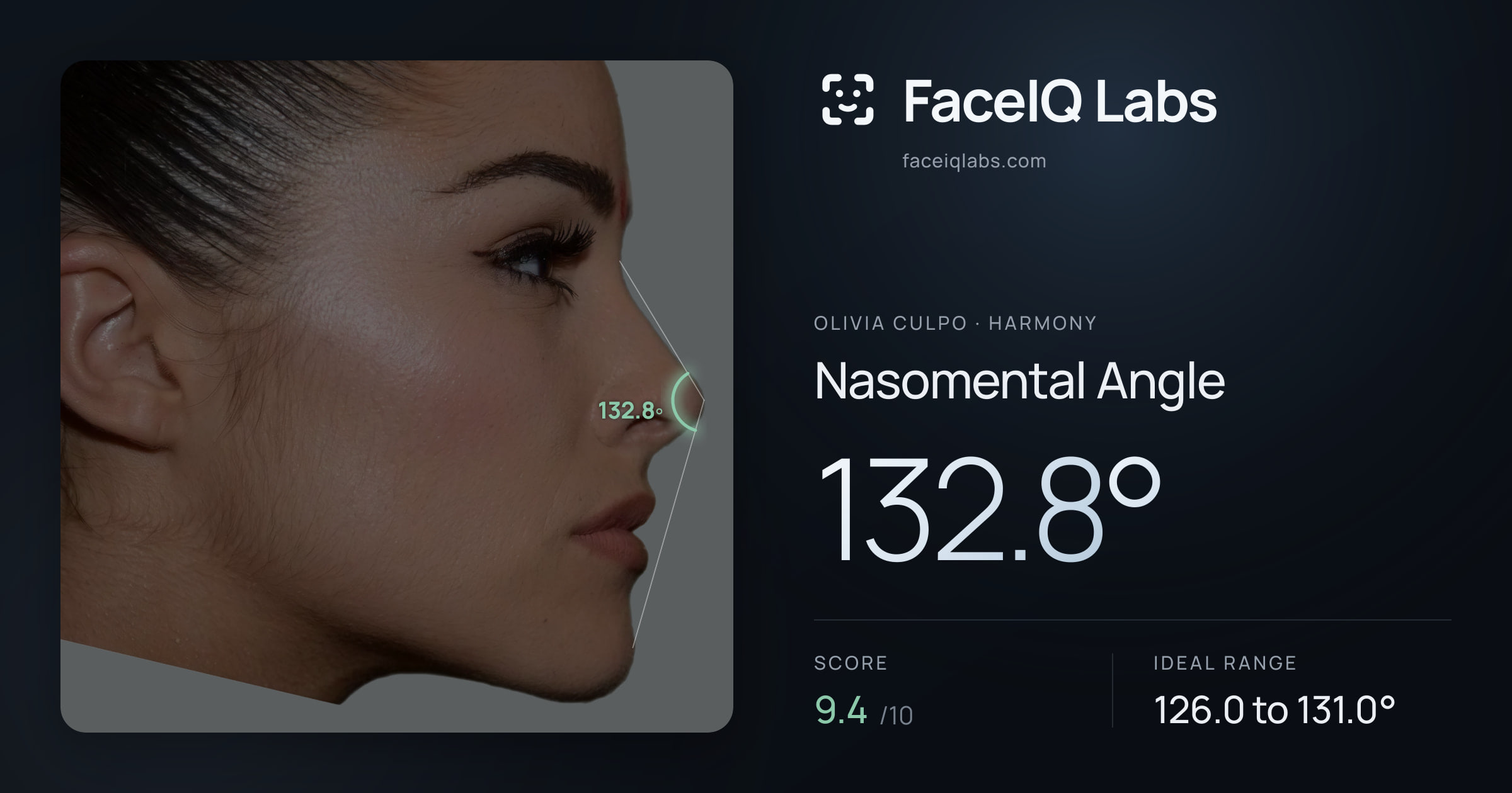 Olivia Culpo Nasomental Angle: 132.8°, drawn on the photo