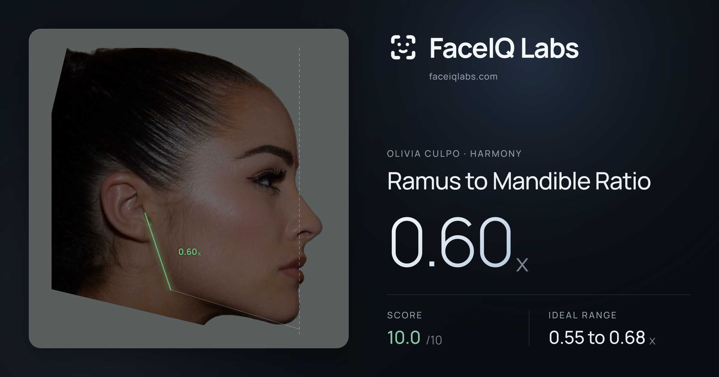 Olivia Culpo Ramus to Mandible Ratio: 0.60x, drawn on the photo
