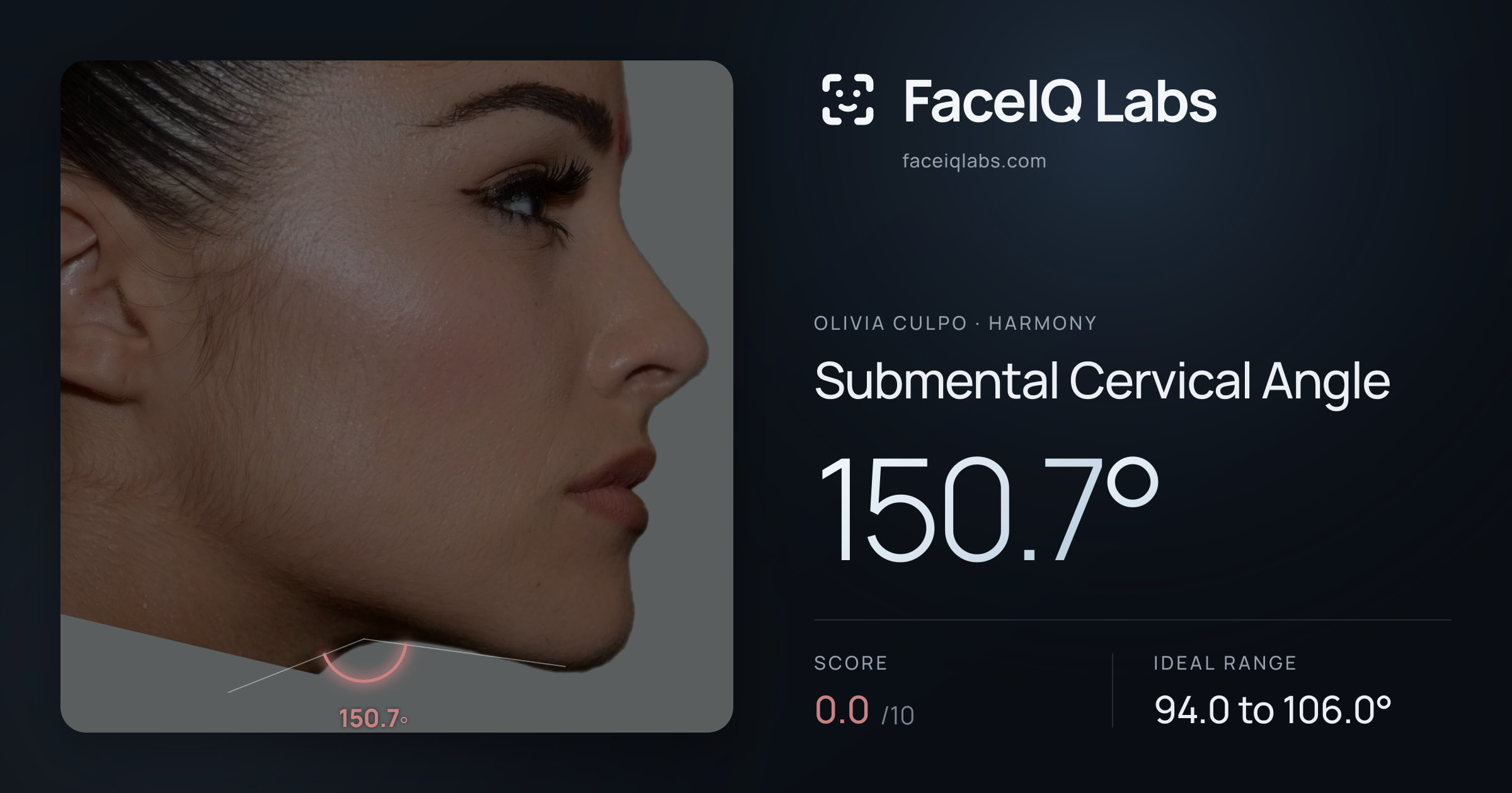 Olivia Culpo Submental Cervical Angle: 150.7°, drawn on the photo