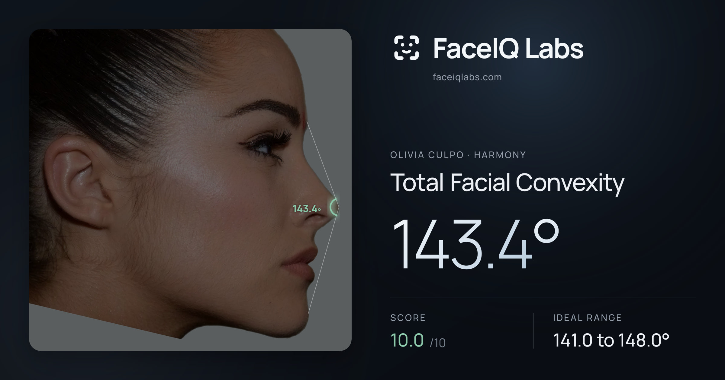 Olivia Culpo Total Facial Convexity: 143.4°, drawn on the photo