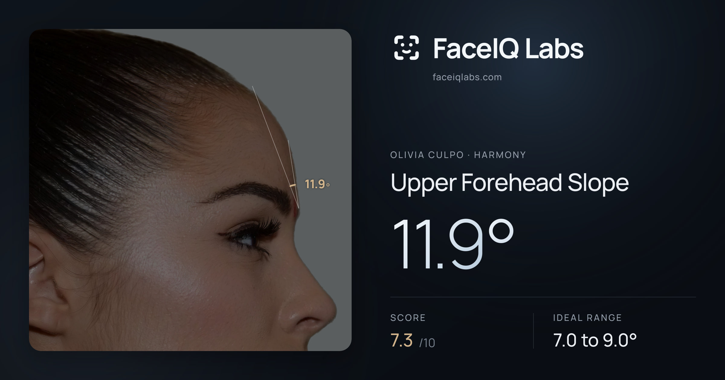 Olivia Culpo Upper Forehead Slope: 11.9°, drawn on the photo