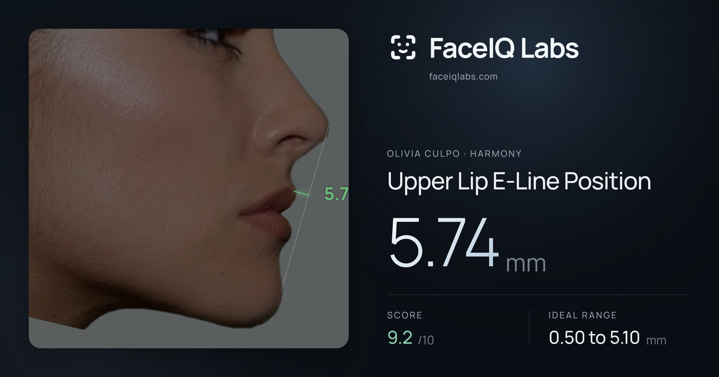 Olivia Culpo Upper Lip E-Line Position: 5.74mm, drawn on the photo