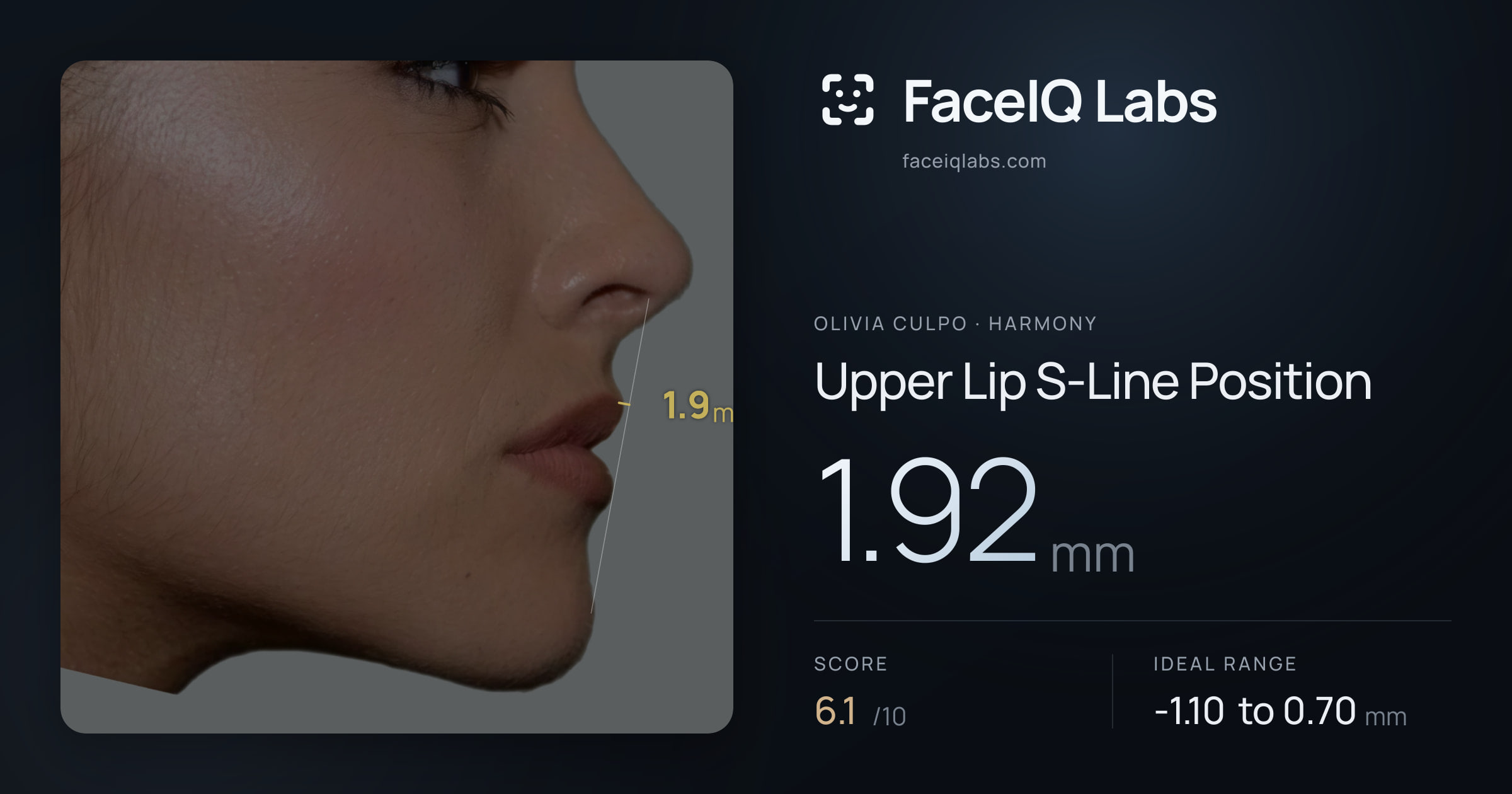 Olivia Culpo Upper Lip S-Line Position: 1.92mm, drawn on the photo