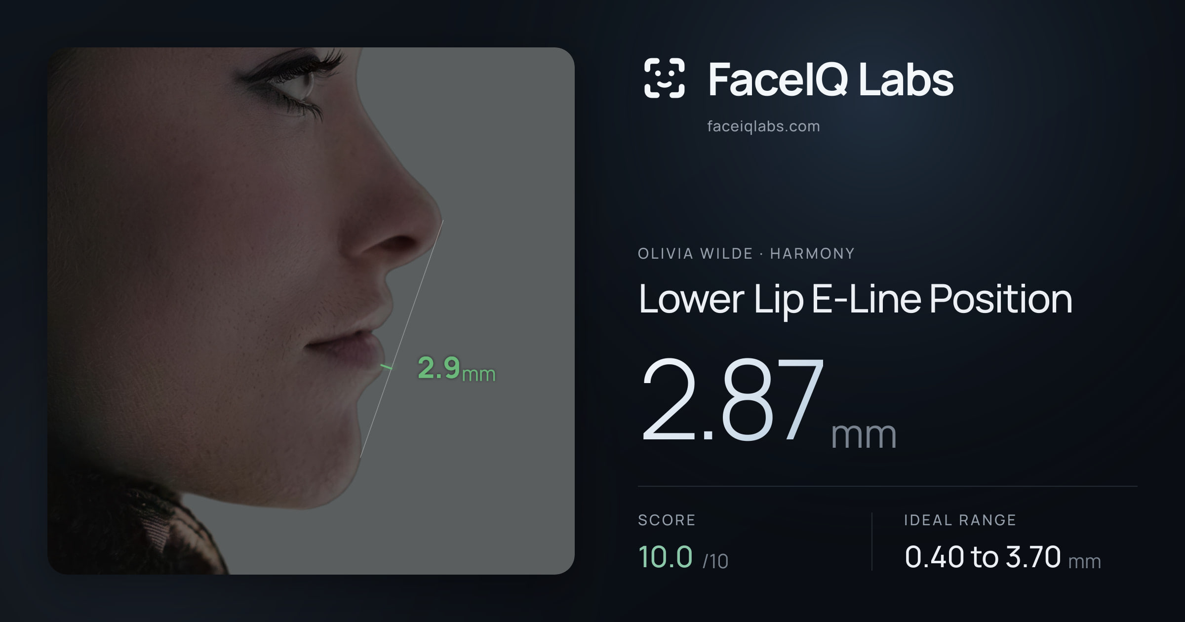 Olivia Wilde Lower Lip E-Line Position: 2.87mm, drawn on the photo