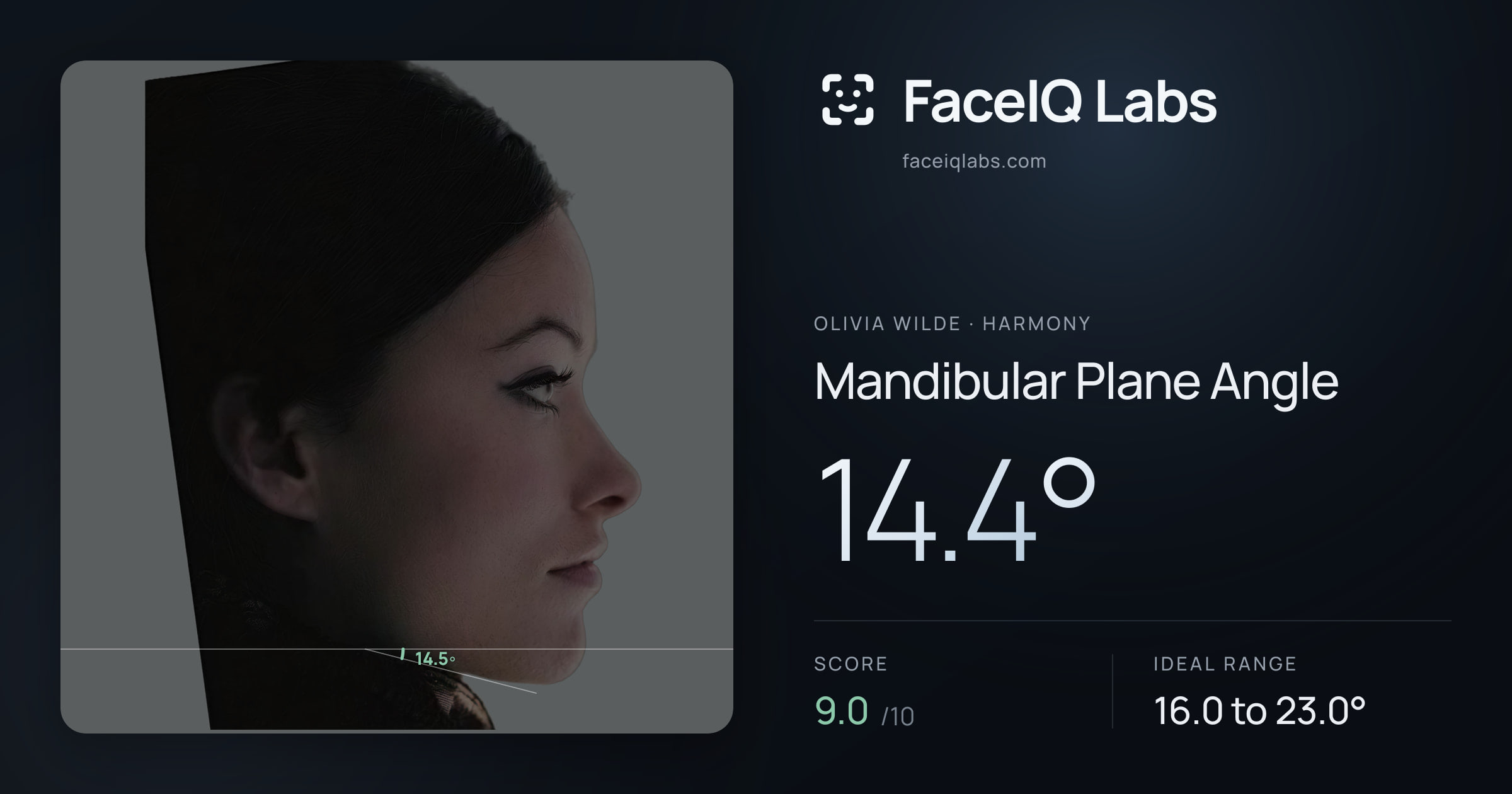 Olivia Wilde Mandibular Plane Angle: 14.4°, drawn on the photo