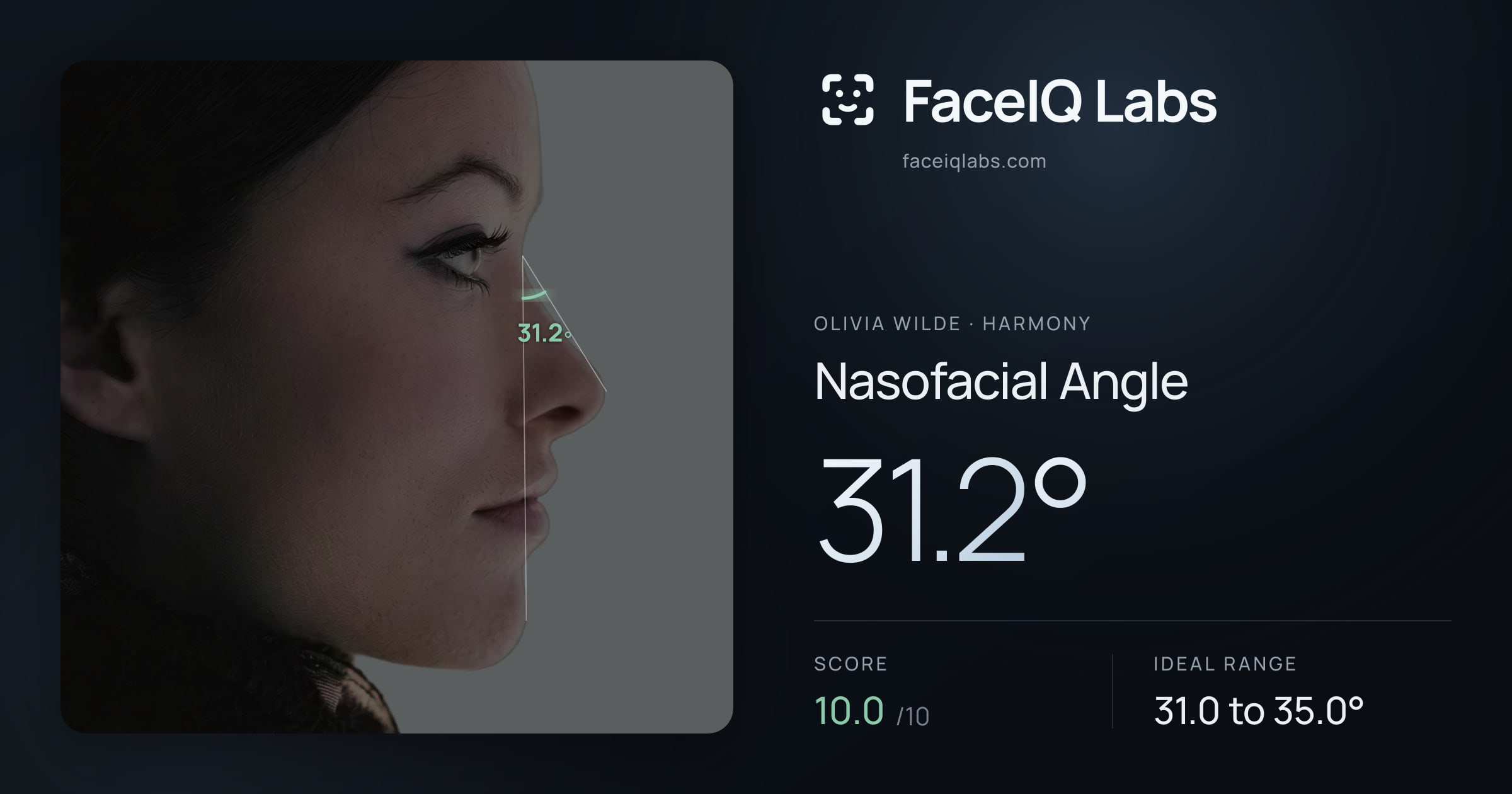 Olivia Wilde Nasofacial Angle: 31.2°, drawn on the photo