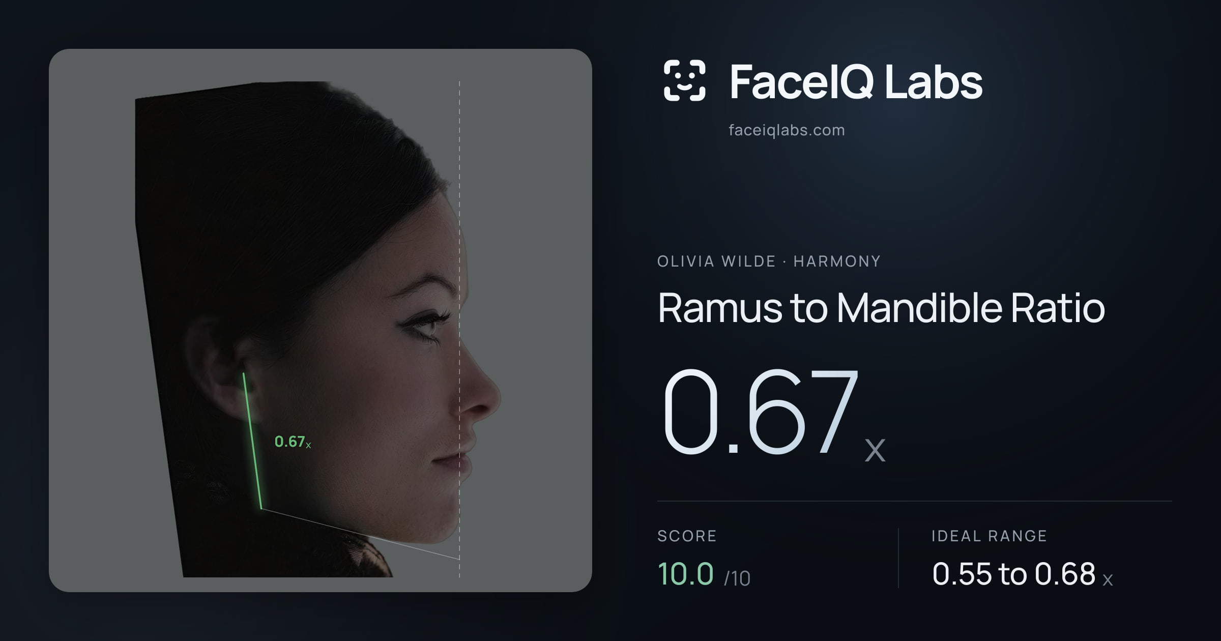 Olivia Wilde Ramus to Mandible Ratio: 0.67x, drawn on the photo