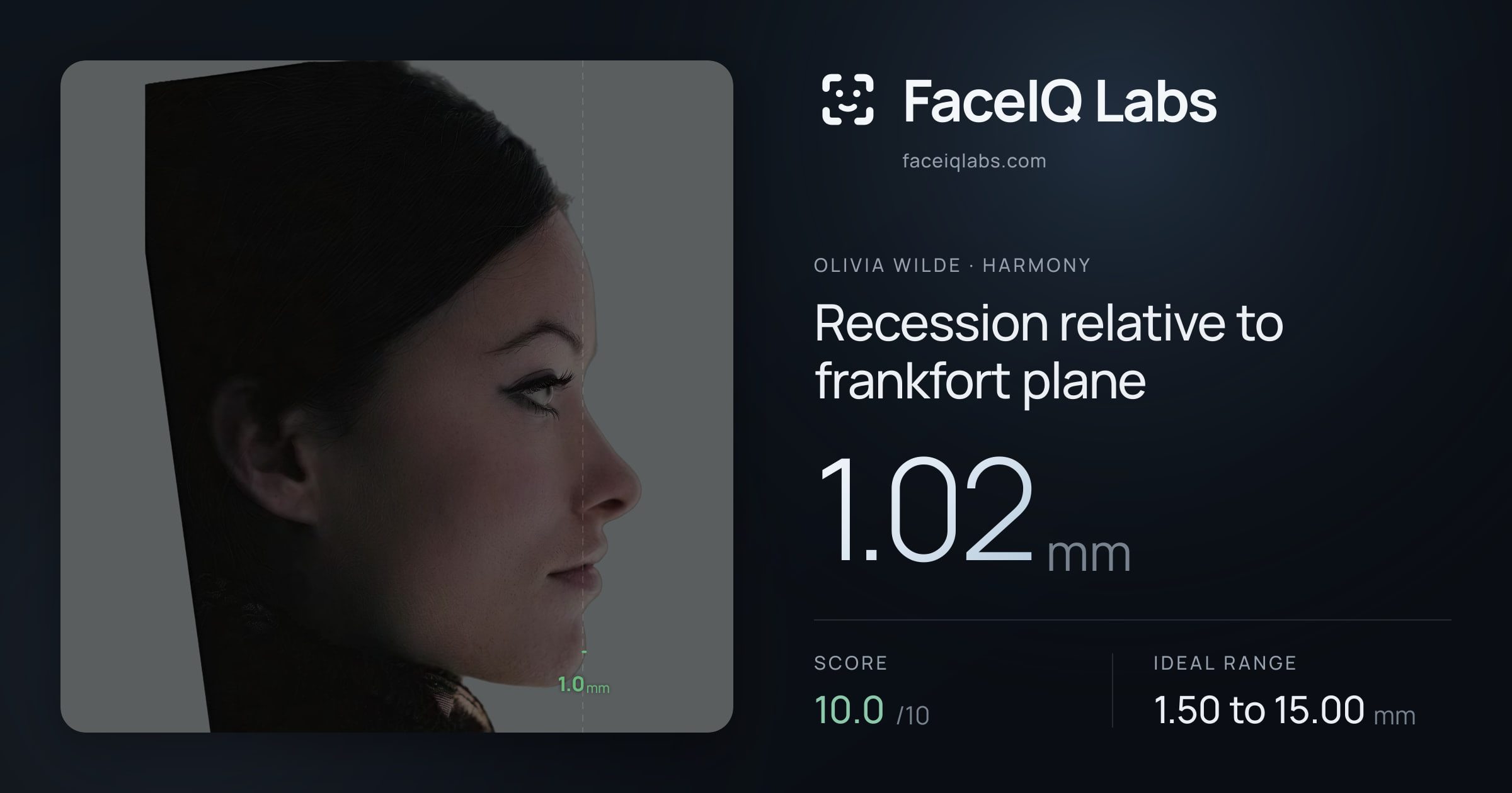 Olivia Wilde Recession relative to frankfort plane: 1.02mm, drawn on the photo
